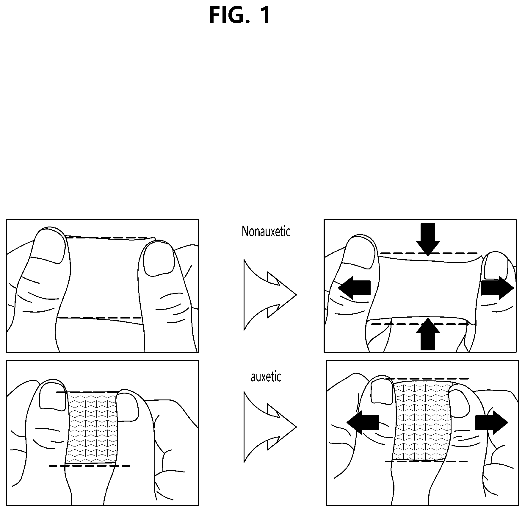 Patent US12324095 — Auxetic stretchable substrate with flexible joint structure and method of manufacturing same — Figure 1