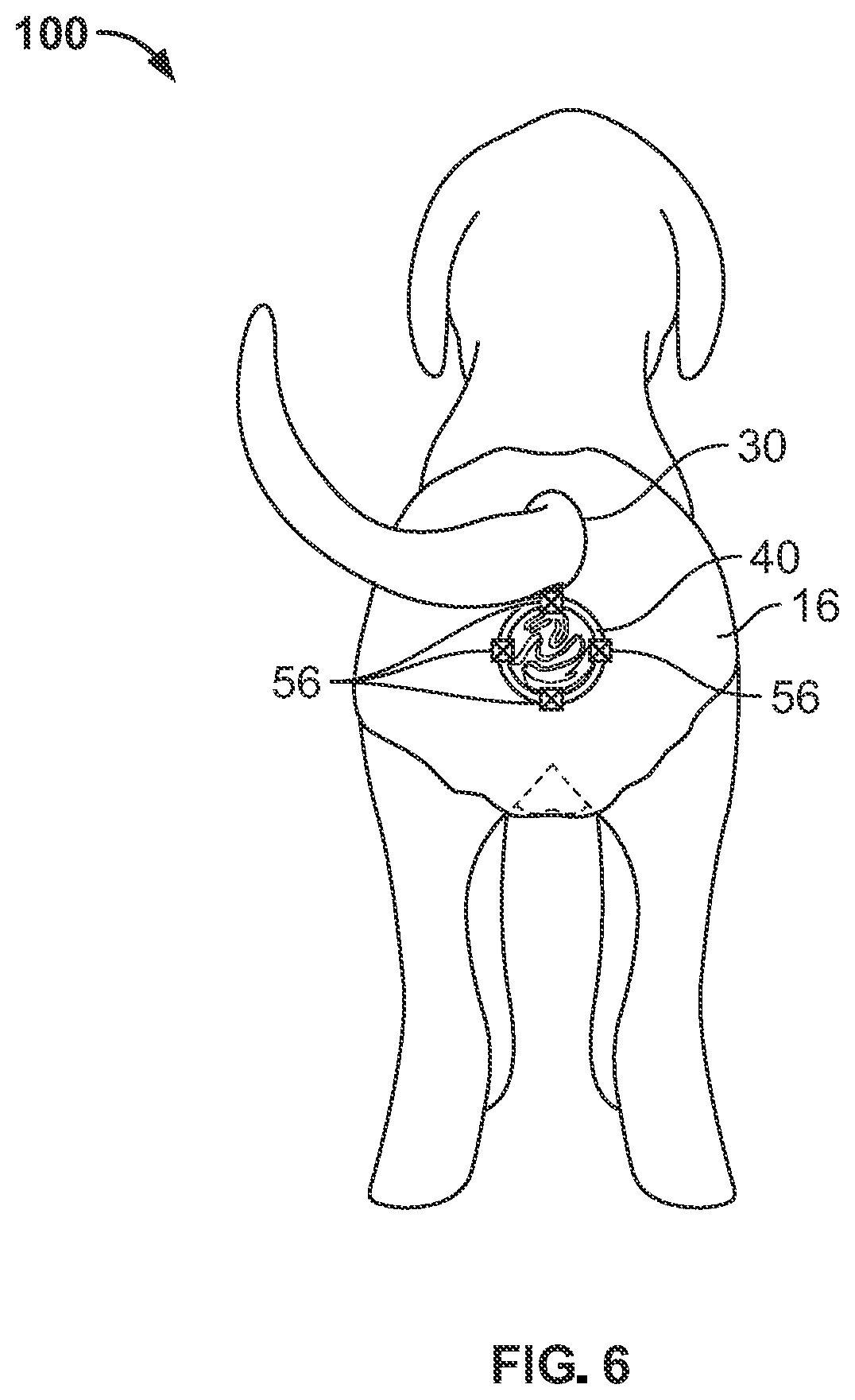 Patent US12324418 Figure 6 – Pet diaper with detachable waste bag