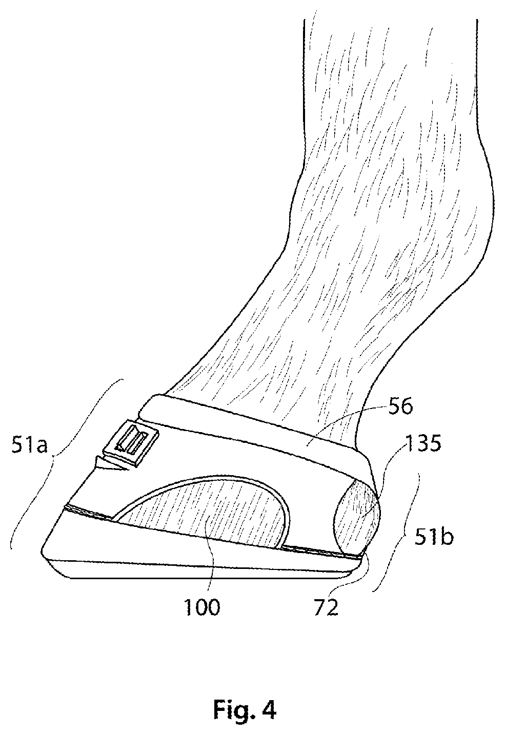 Patent US12324426 Figure 4 – Equine hoof boot