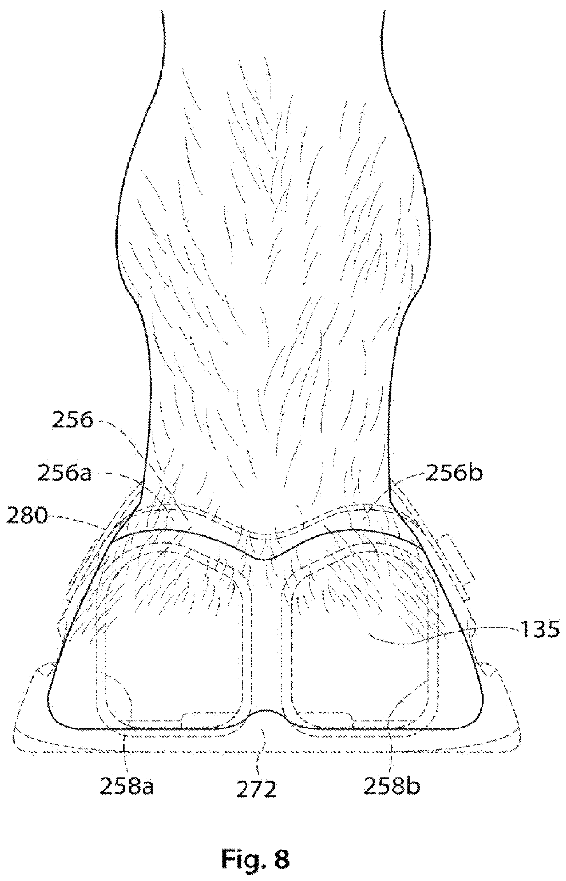 Patent US12324426 Figure 9 – Equine hoof boot