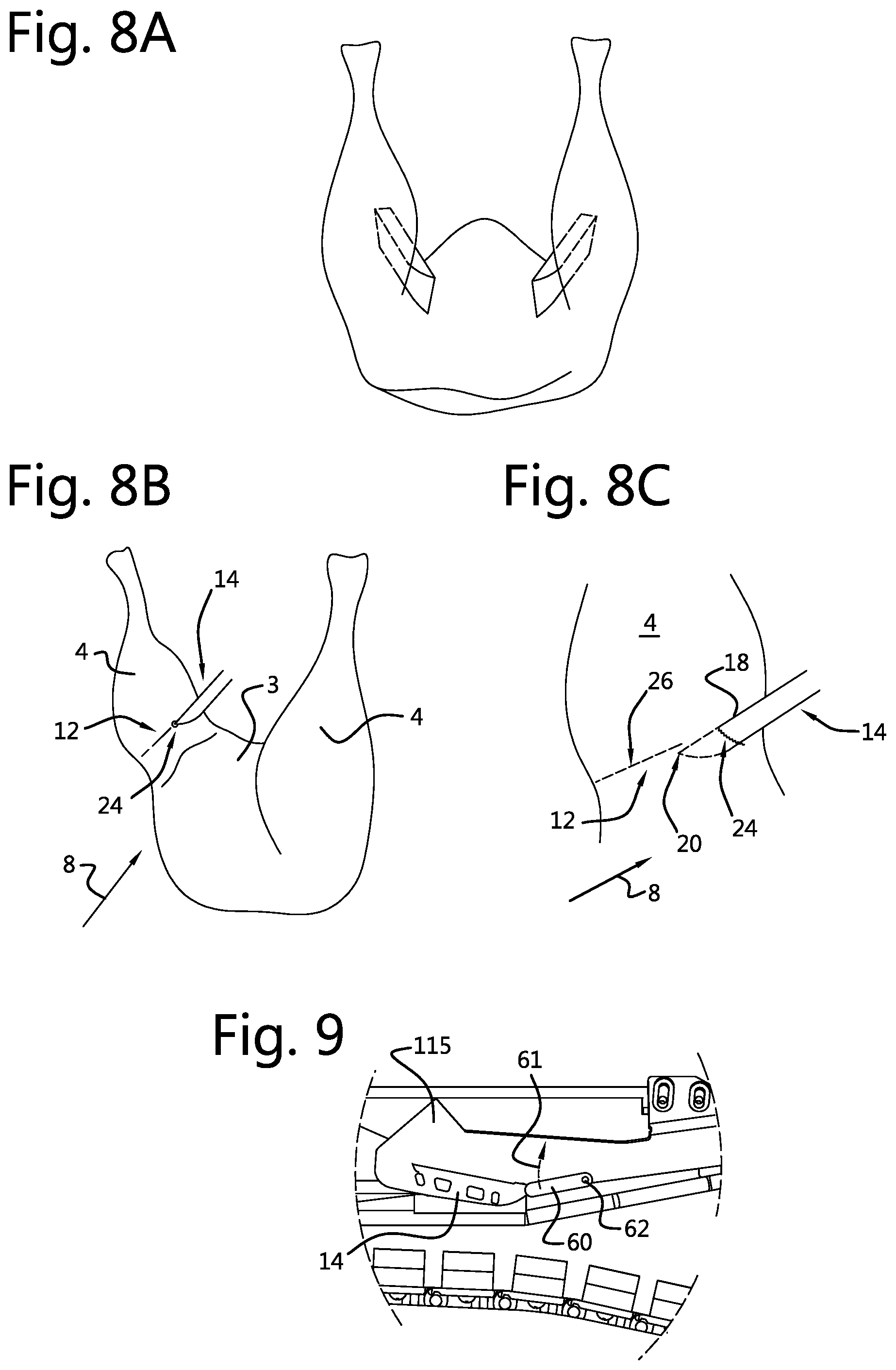 Patent US12324438 Figure 4 – System and method for processing a carcass part