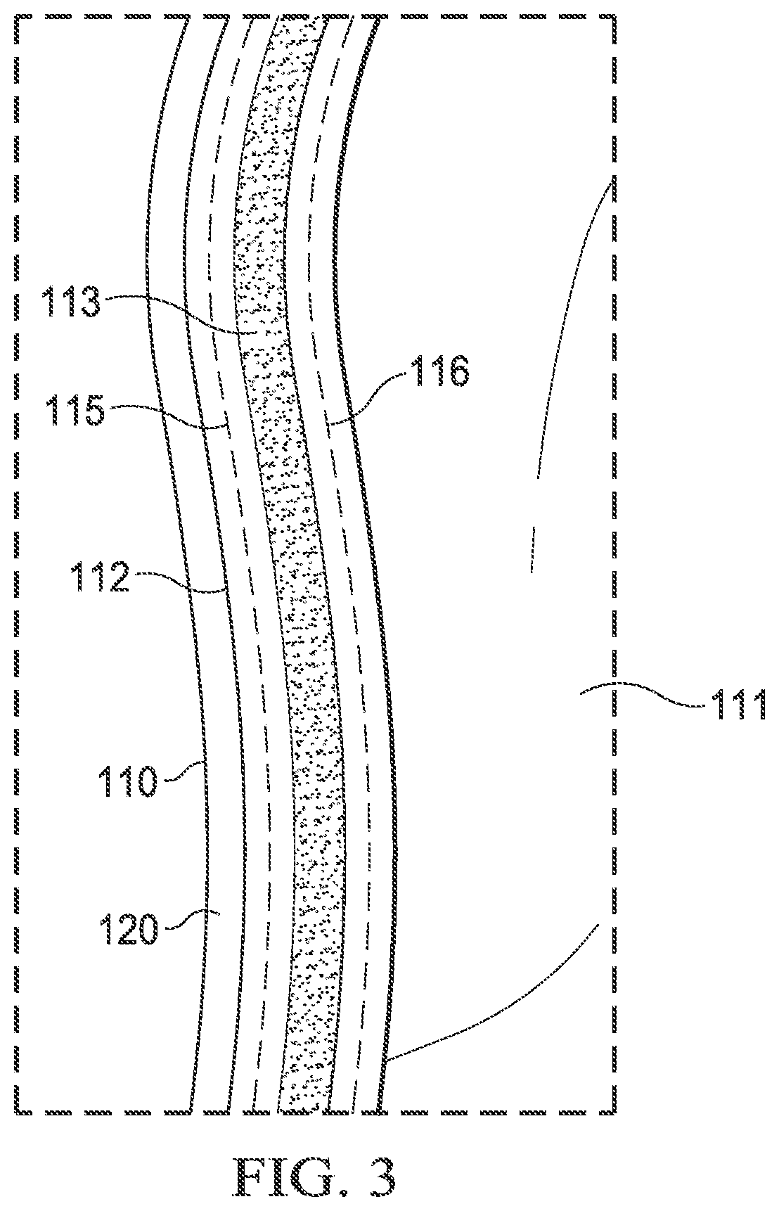 Patent US12324464 Figure 3 – Activewear garment