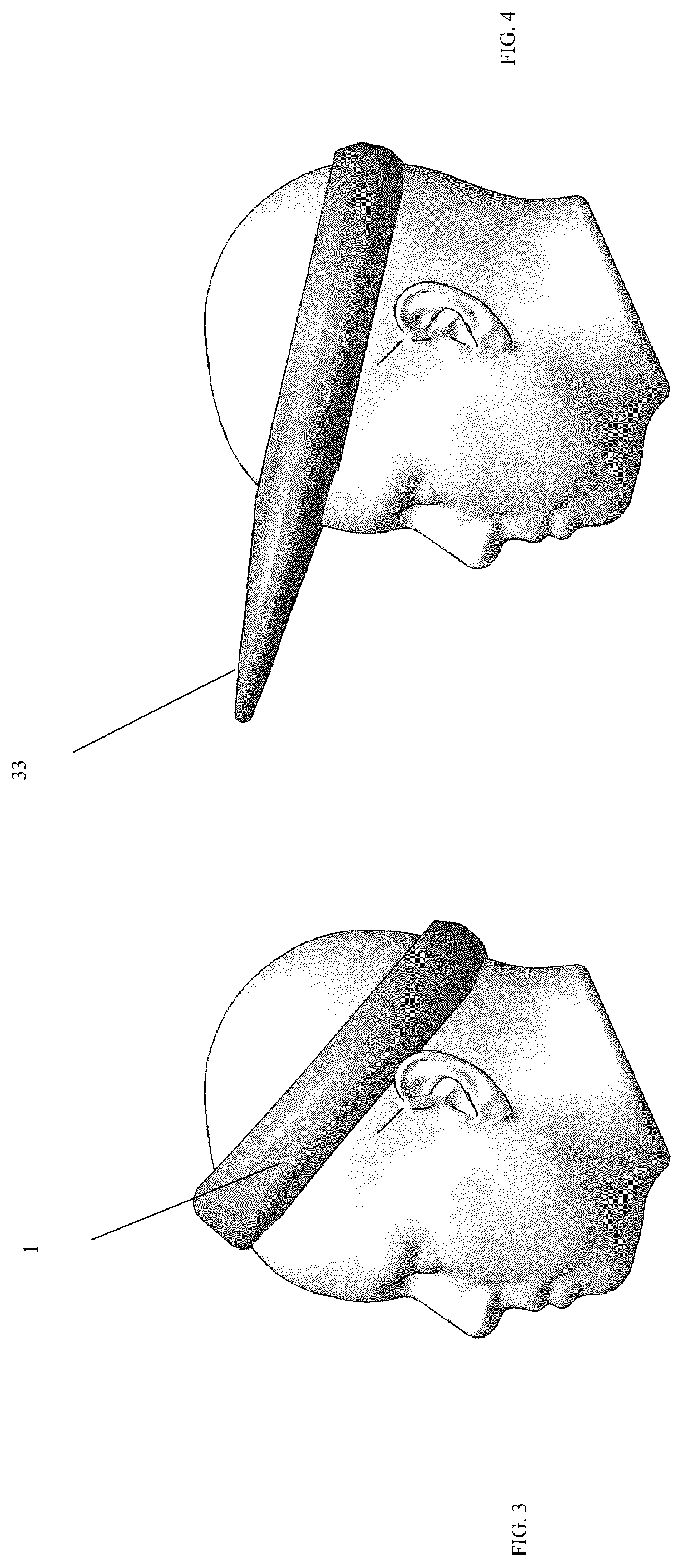 Patent US12324468 Figure 2 – Expandable headband