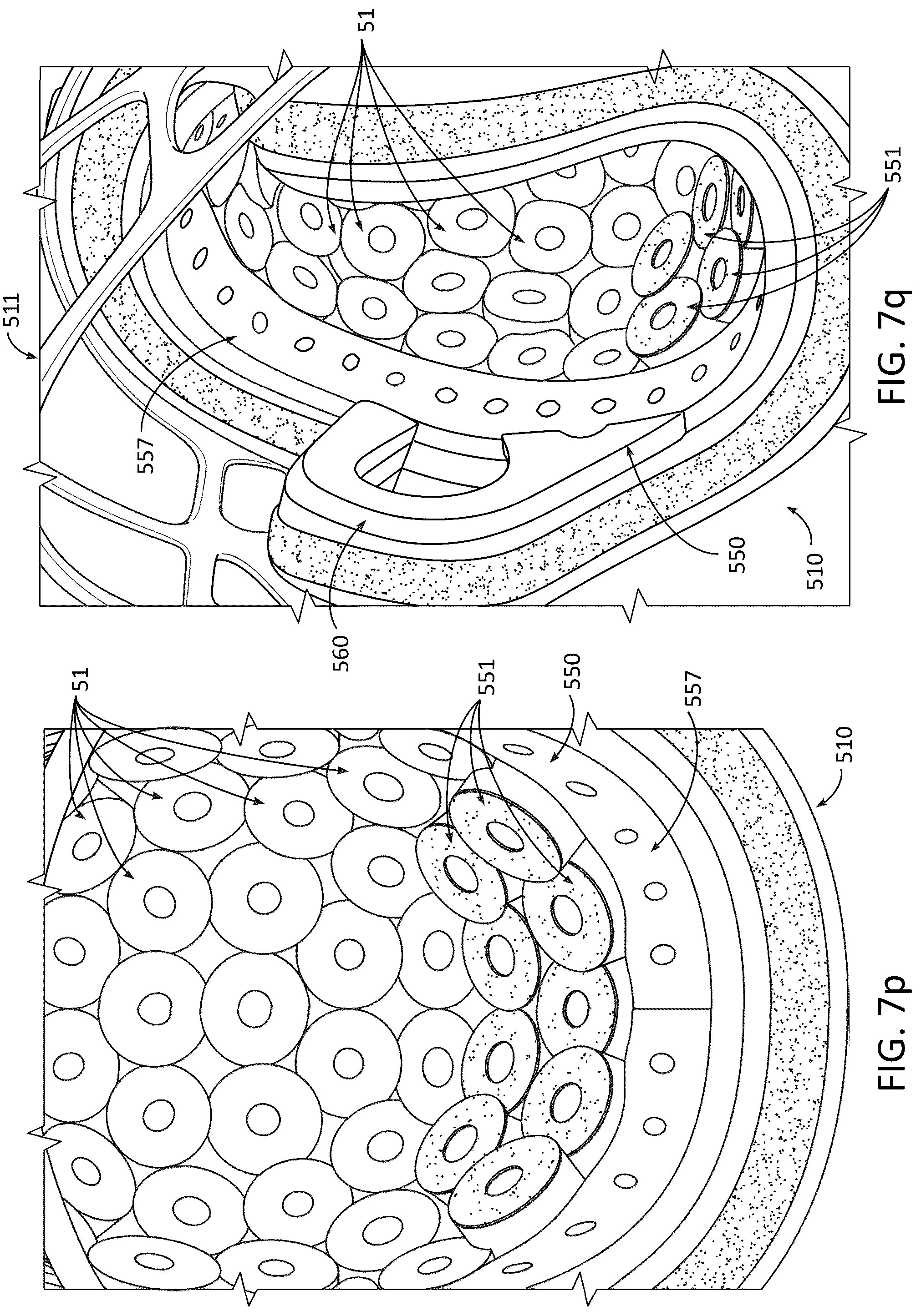 Patent US12324473 Figure 13 – Protective headgear and methods for making same