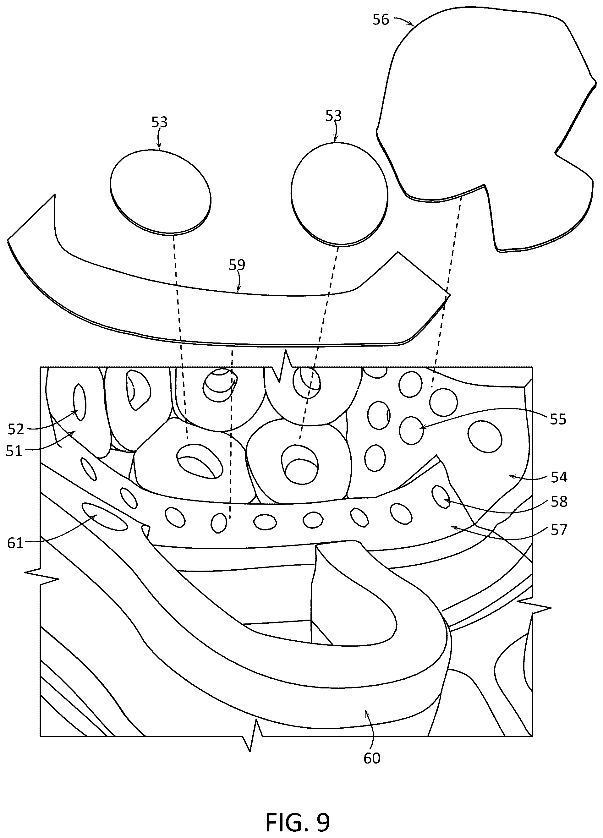 Patent US12324473 Figure 16 – Protective headgear and methods for making same