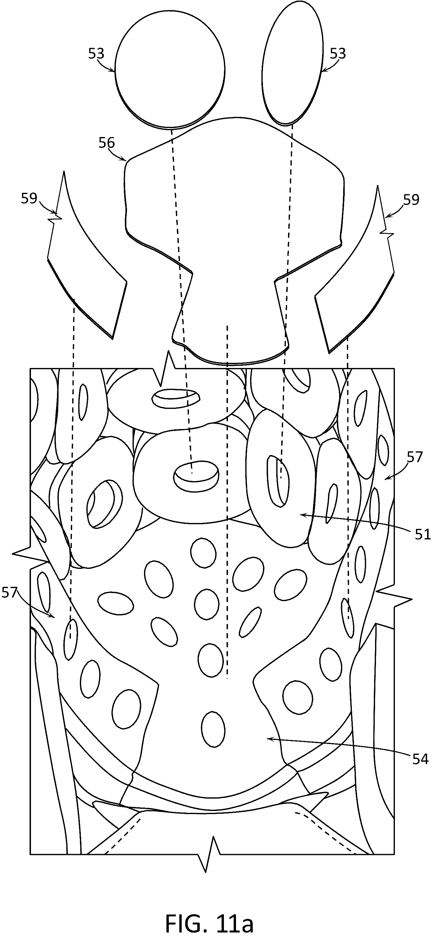 Patent US12324473 Figure 18 – Protective headgear and methods for making same