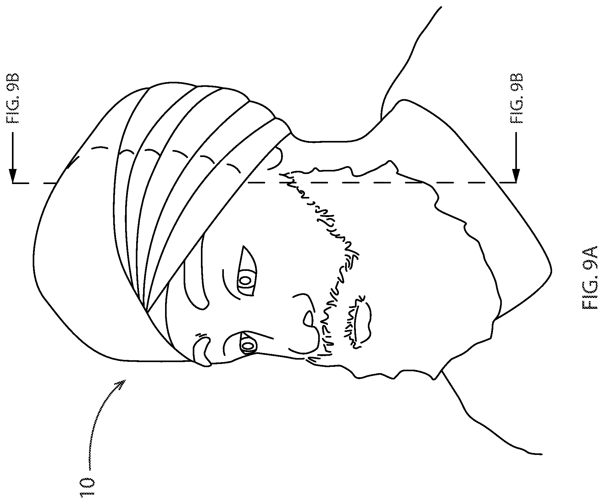 Patent US12324474 Figure 17 – Protective garment assembly
