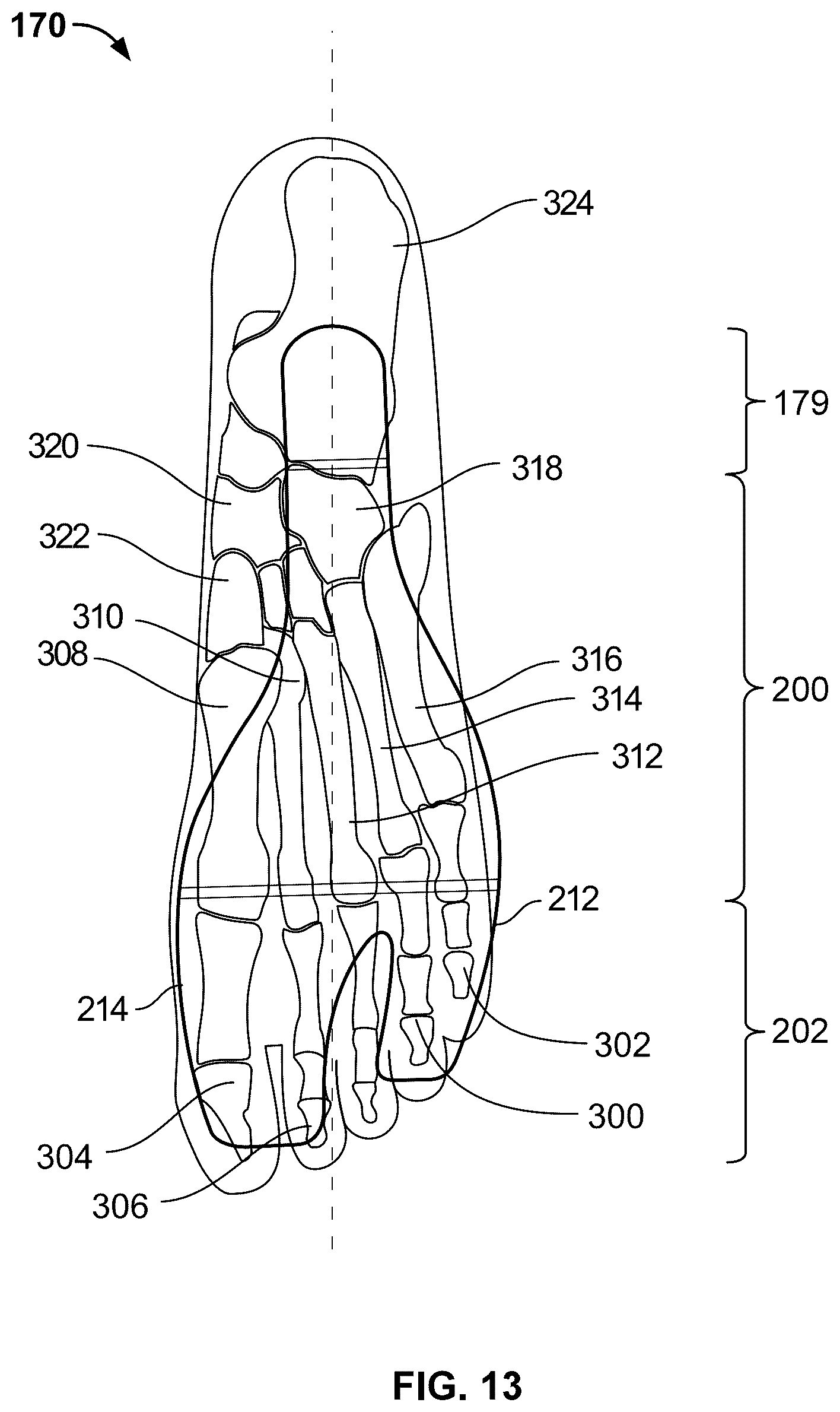 Patent US12324477 Figure 10 – Articles of footwear with support structures