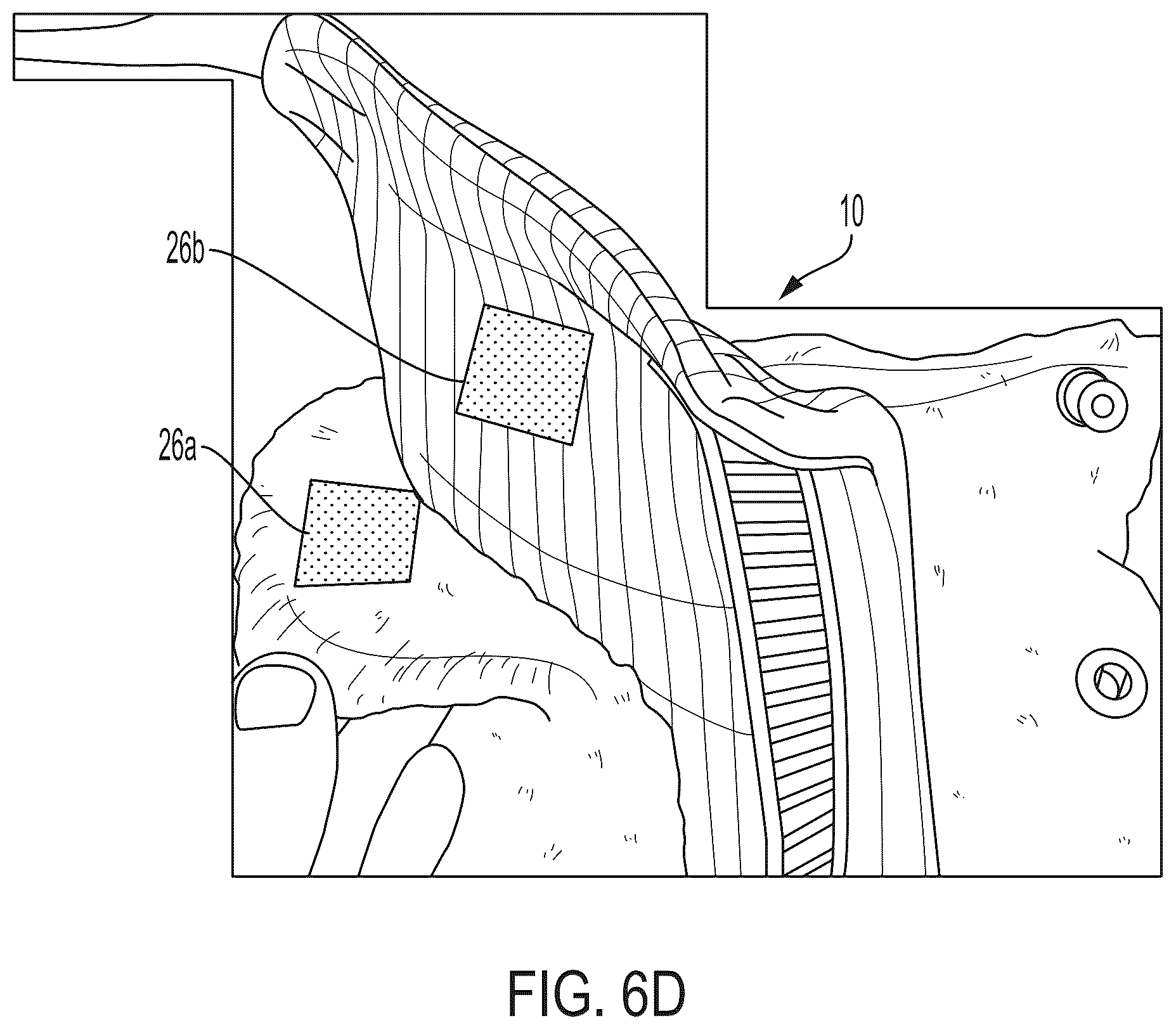 Patent US12324483 Figure 12 – Apparatus to prevent contact between spur or riding boot and a horse