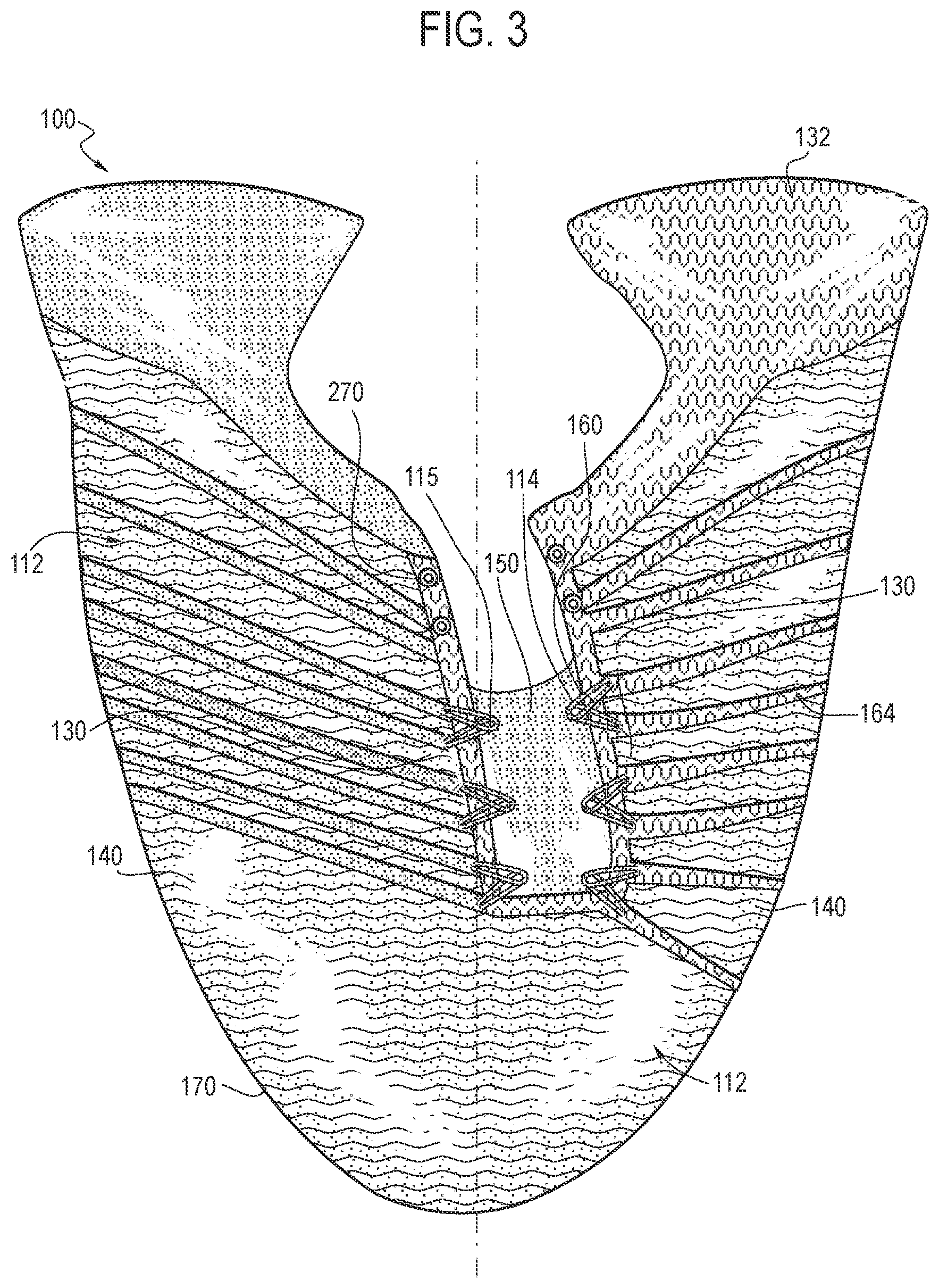 Patent US12324484 Figure 3 – Upper for an article of footwear having an inner component and a shroud