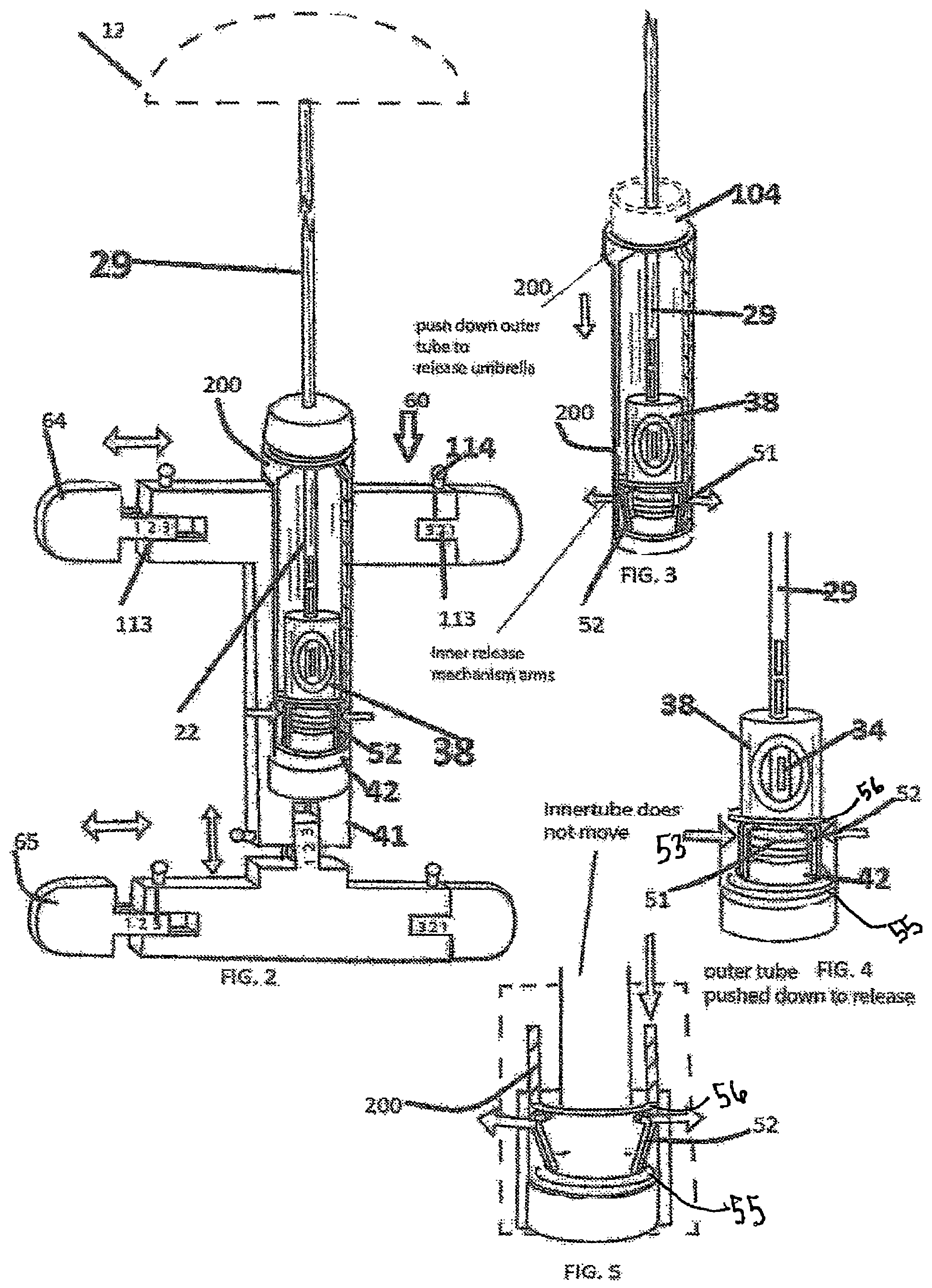 Patent US12324491 Figure 2 – Universal pack-a-rella anchoring support