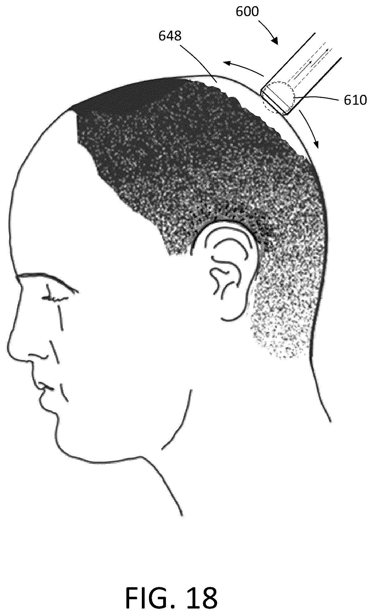 Patent US12324500 Figure 16 – Systems and methods for treating lips and skin