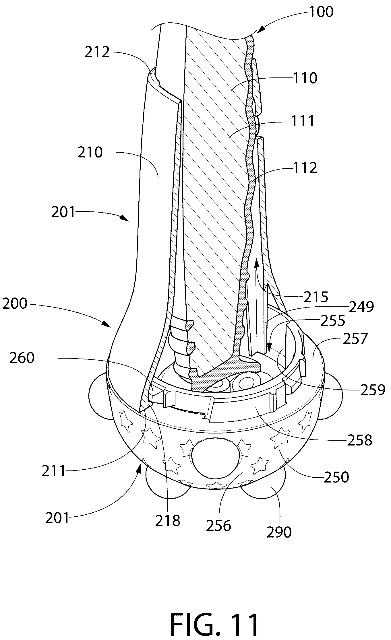 Patent US12324504 Figure 13 – Oral care system with a tracking attachment and method of assembling the same