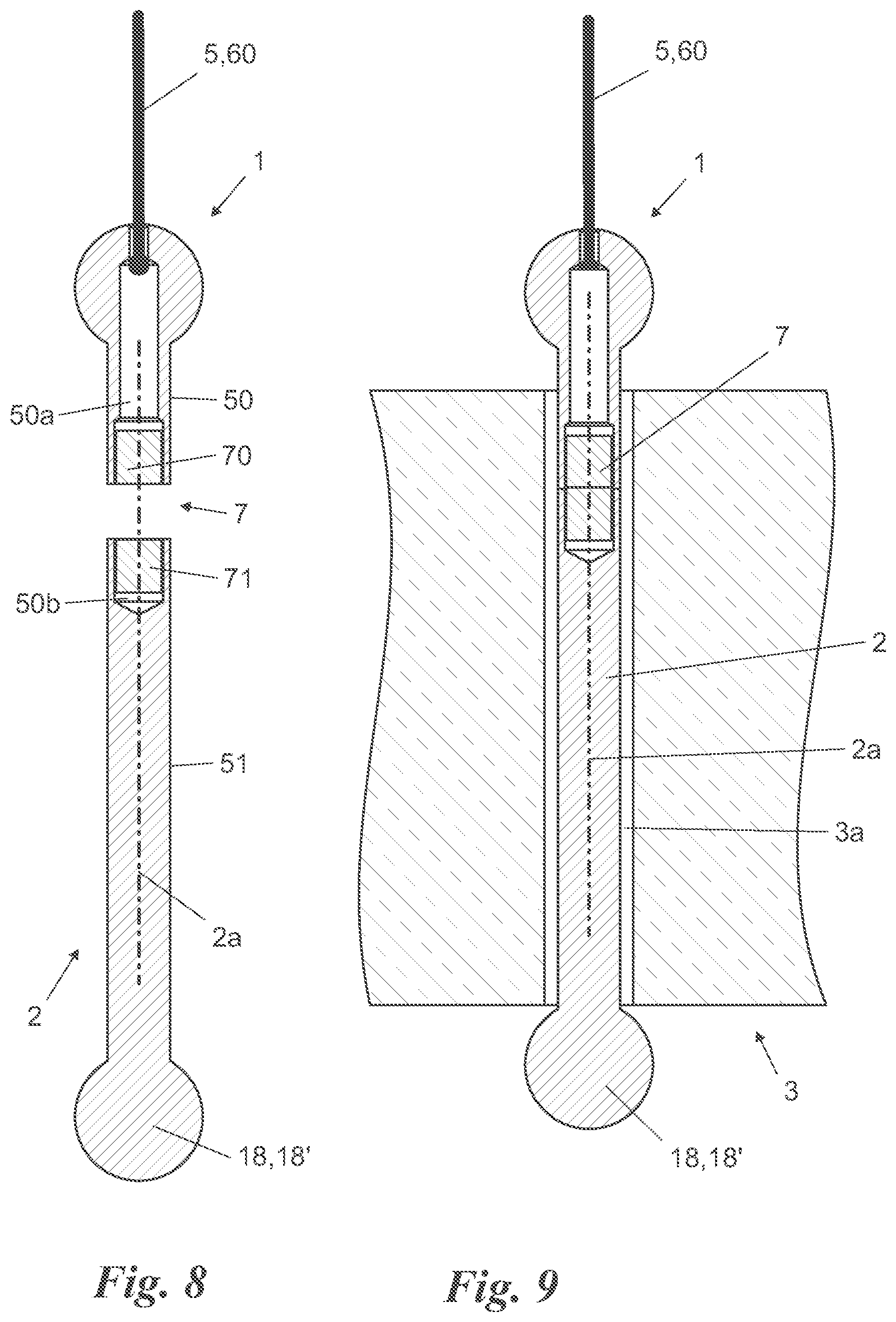 Patent US12324548 Figure 3 – Soap holder