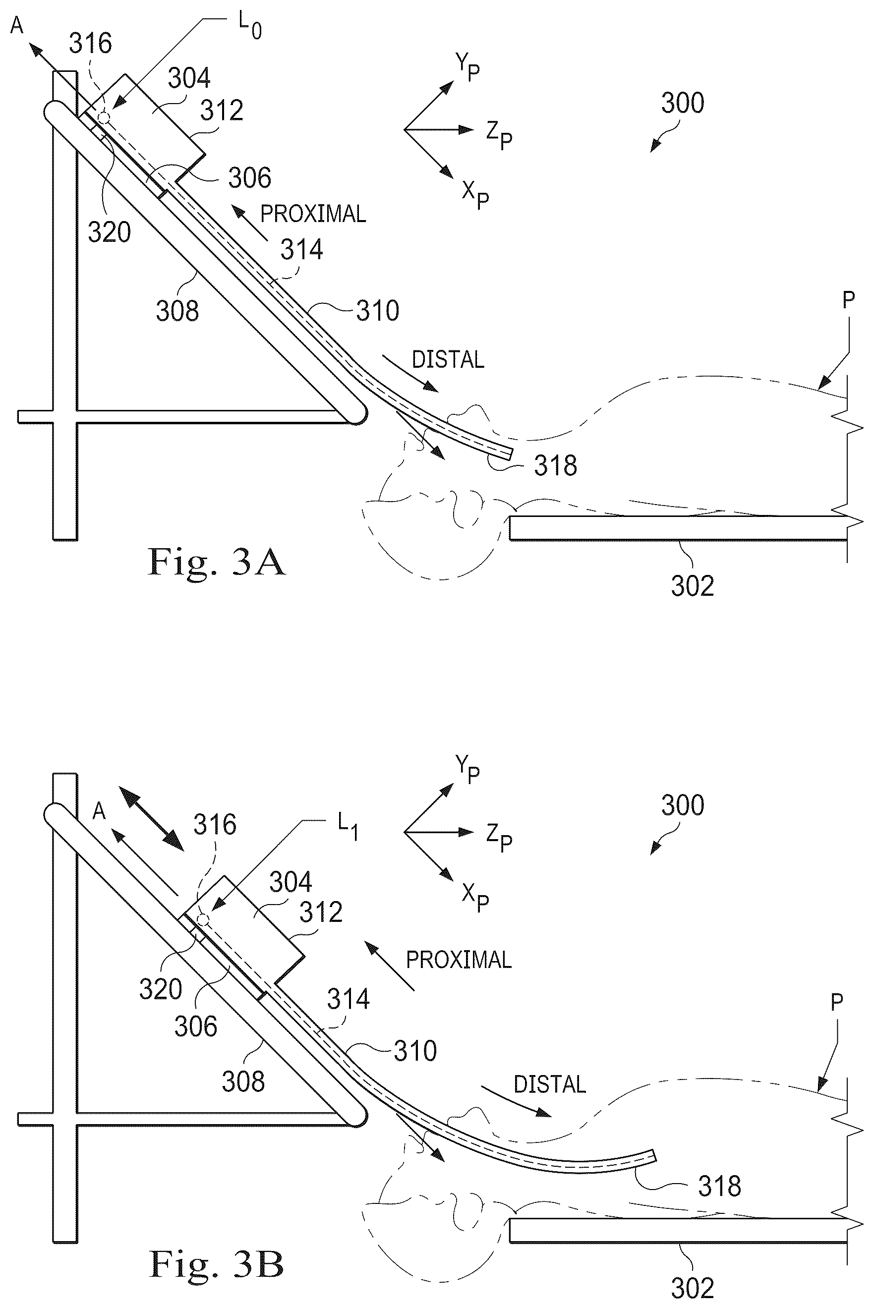 Patent US12324560 Figure 3 – Systems and methods for detecting an orientation of medical instruments