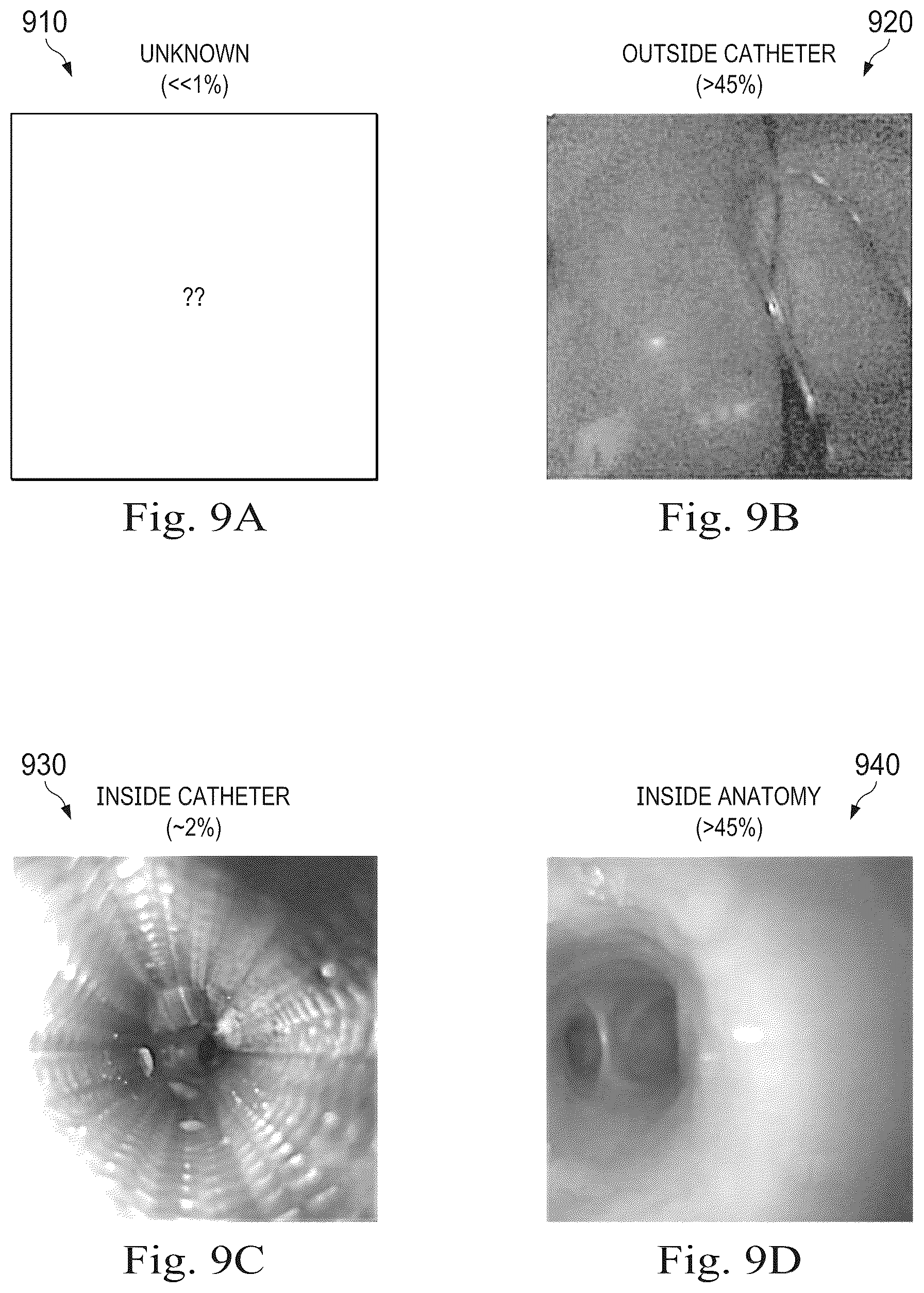 Patent US12324560 Figure 14 – Systems and methods for detecting an orientation of medical instruments