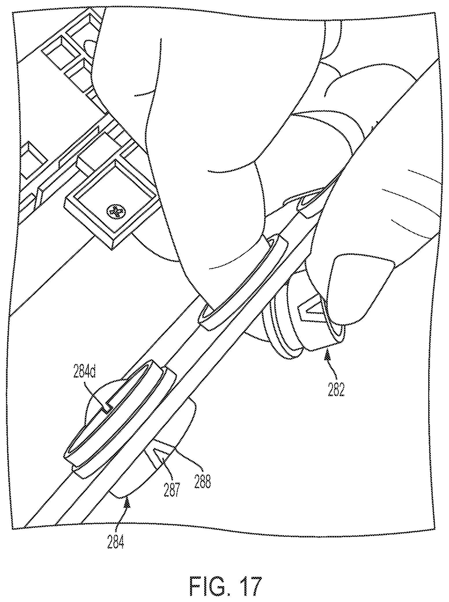 Patent US12324562 Figure 17 – Video processing device
