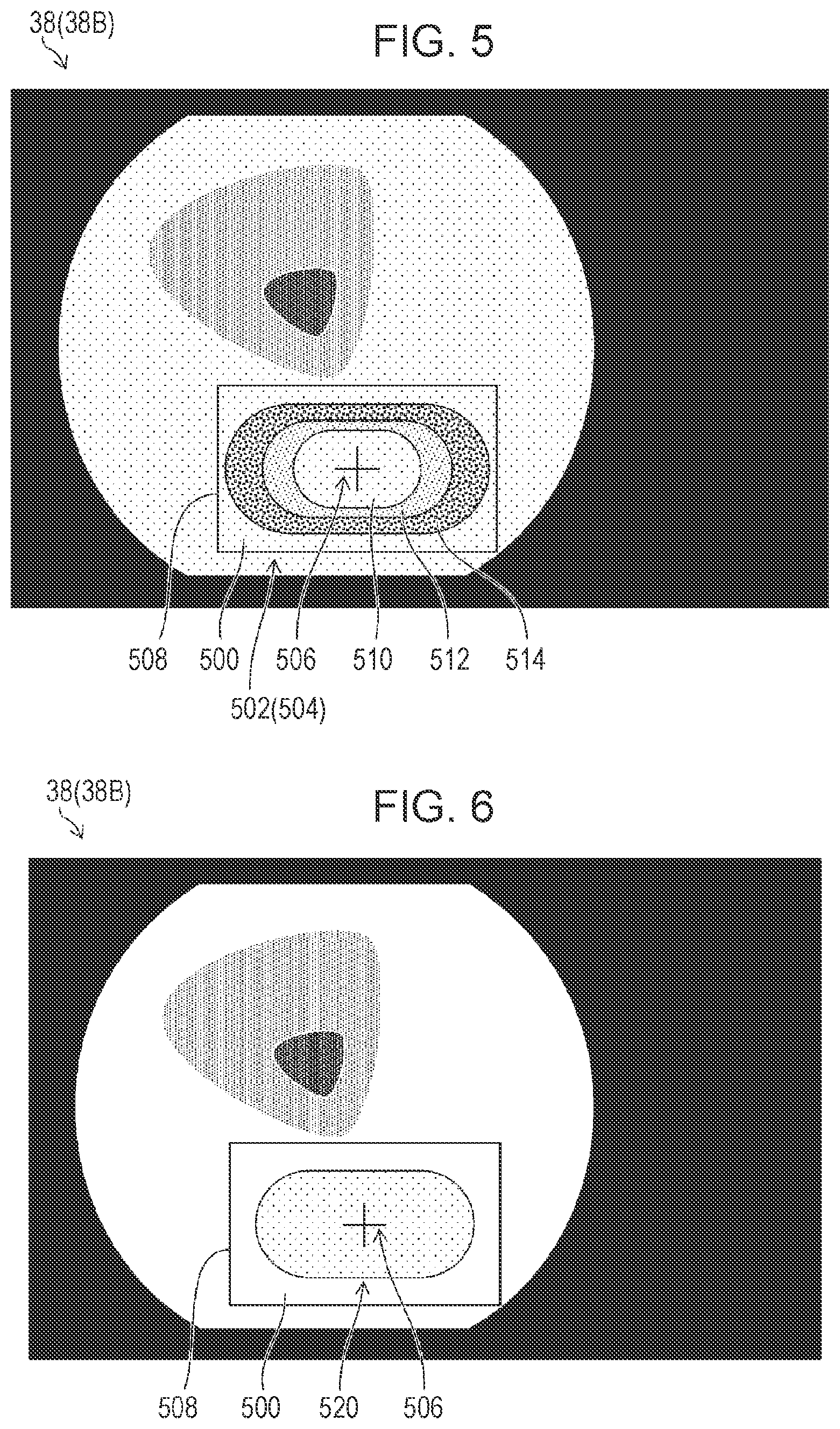 Patent US12324563 Figure 5 – Image processing apparatus, processor apparatus, endoscope system, image processing method, and program enabling notification of a biopsy certainty factor