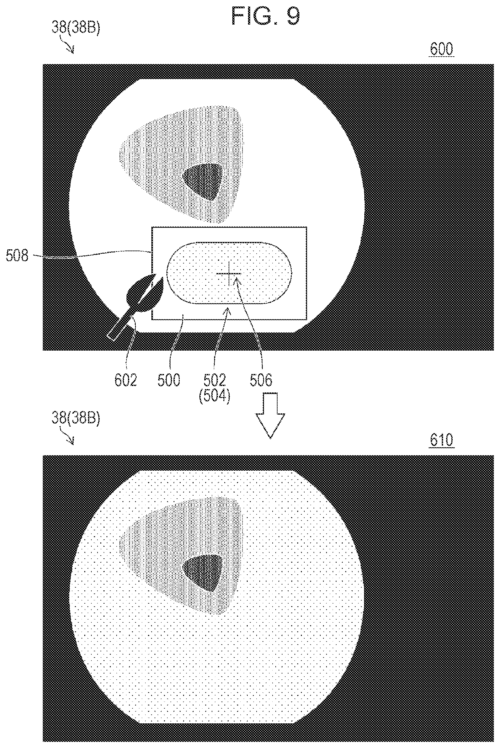Patent US12324563 Figure 8 – Image processing apparatus, processor apparatus, endoscope system, image processing method, and program enabling notification of a biopsy certainty factor