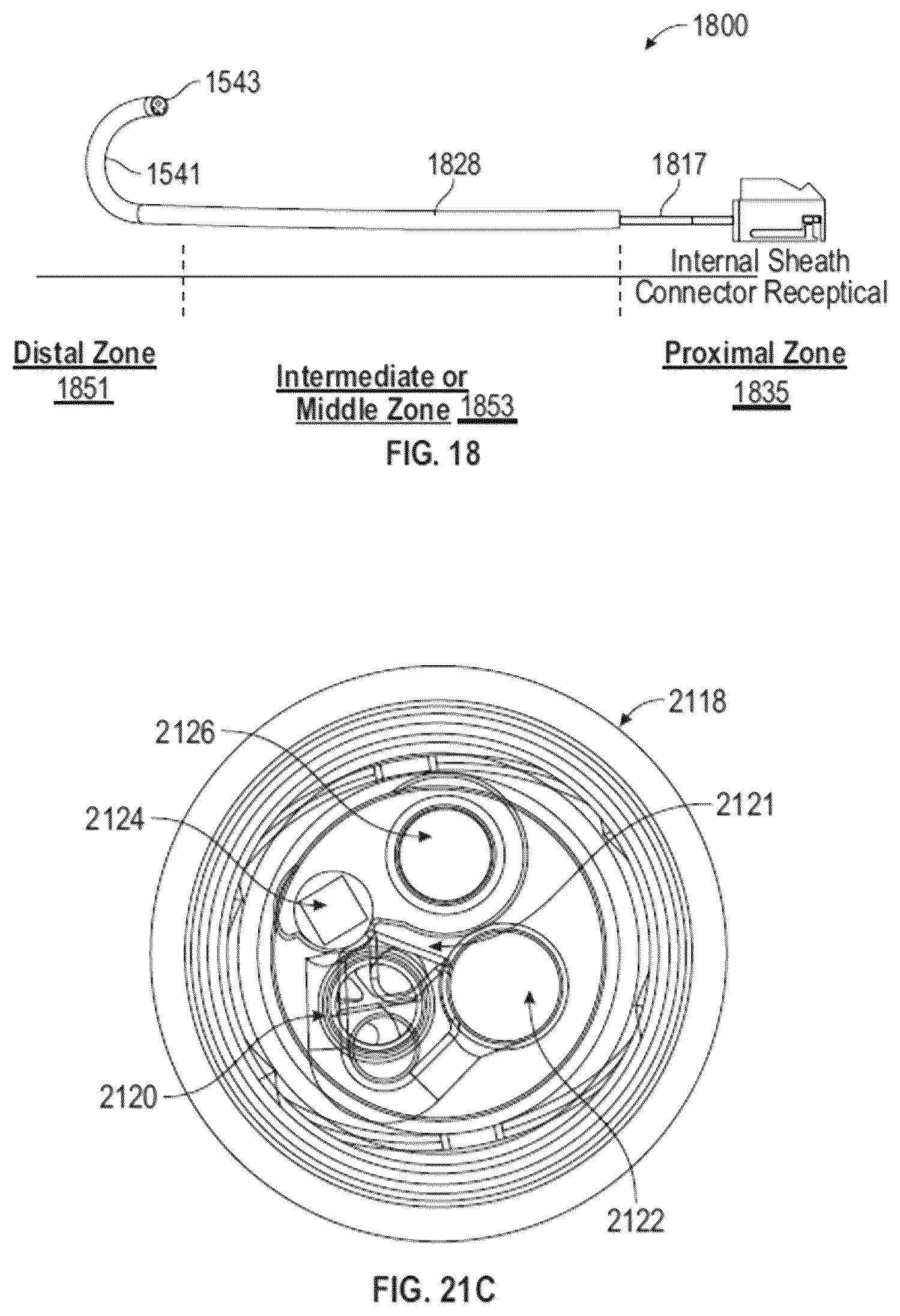 Patent US12324565 Figure 16 – Methods of attaching a rigidizing sheath to an endoscope