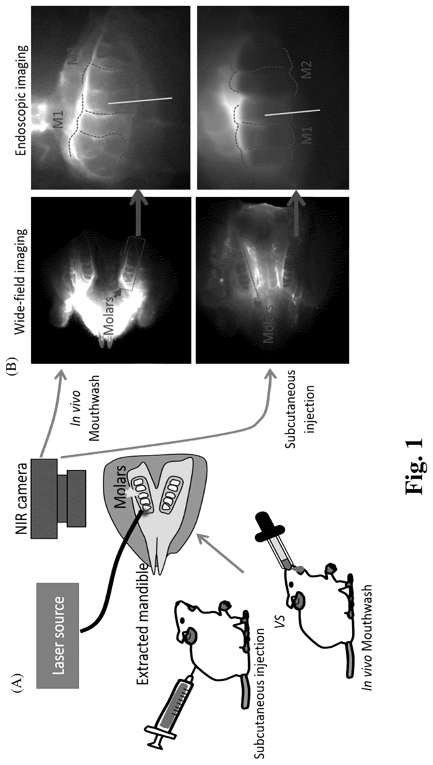Patent US12324568 Figure 1 – Mouthwash to deliver dyes for dental imaging