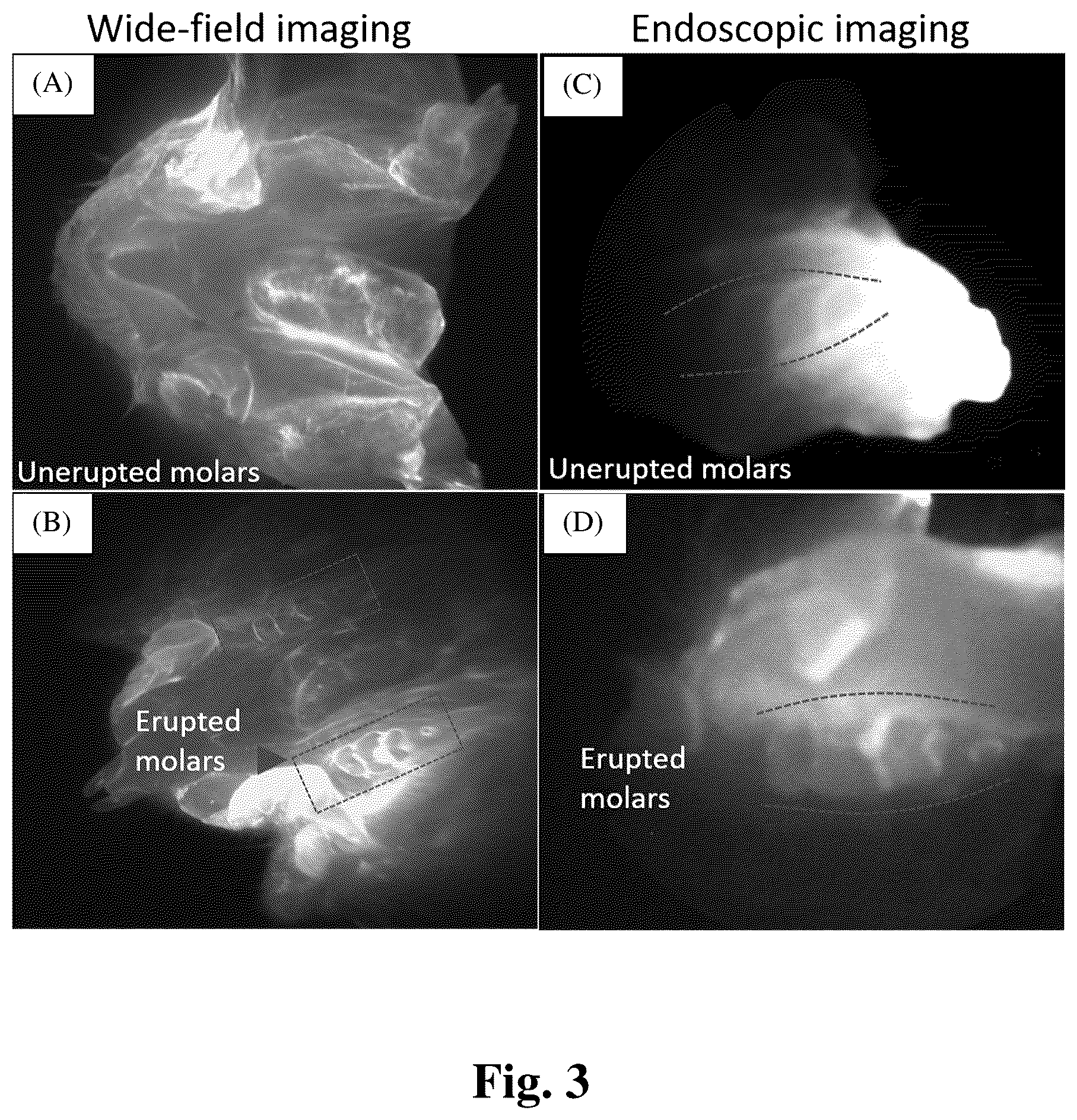 Patent US12324568 Figure 3 – Mouthwash to deliver dyes for dental imaging