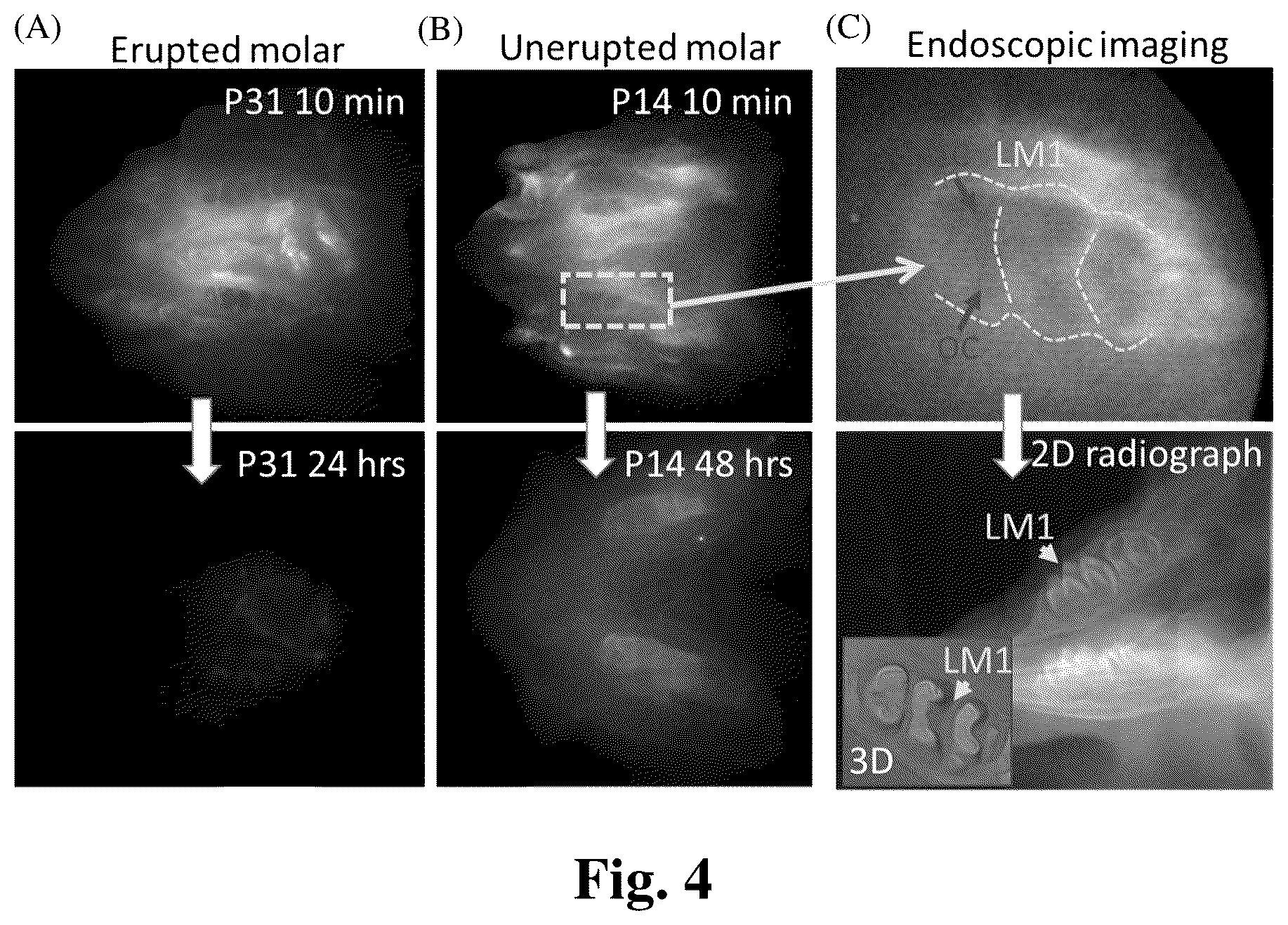 Patent US12324568 Figure 4 – Mouthwash to deliver dyes for dental imaging