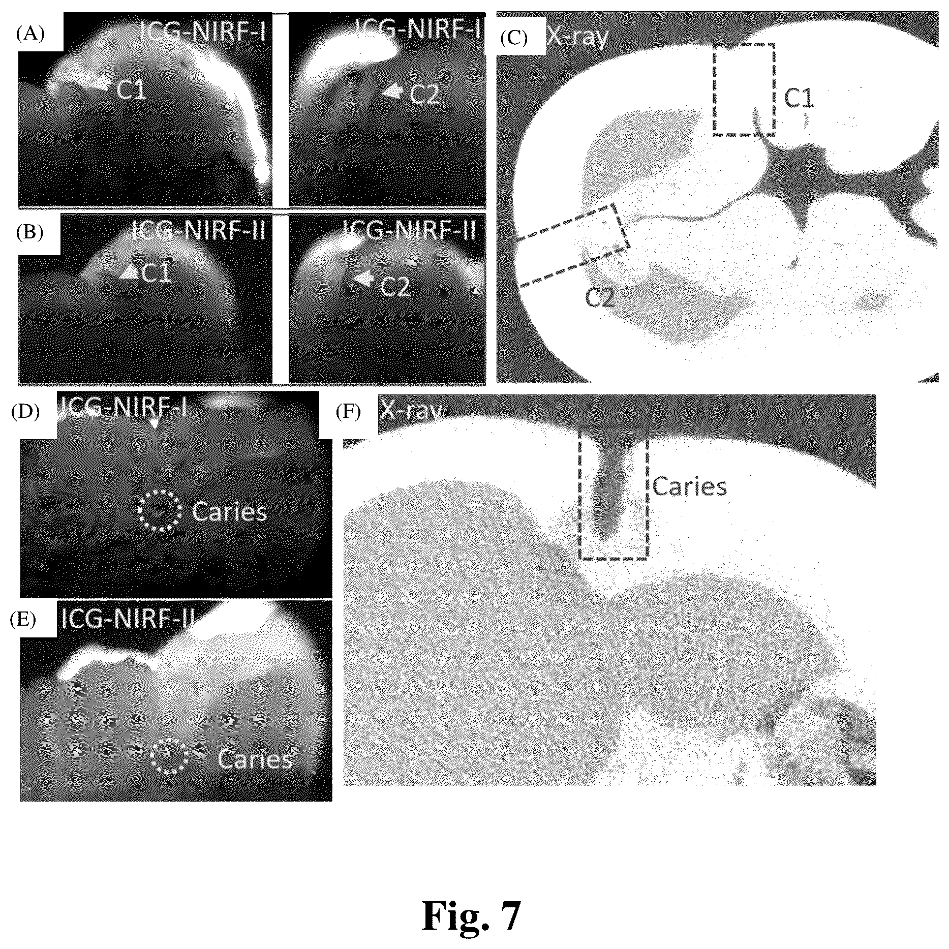 Patent US12324568 Figure 7 – Mouthwash to deliver dyes for dental imaging