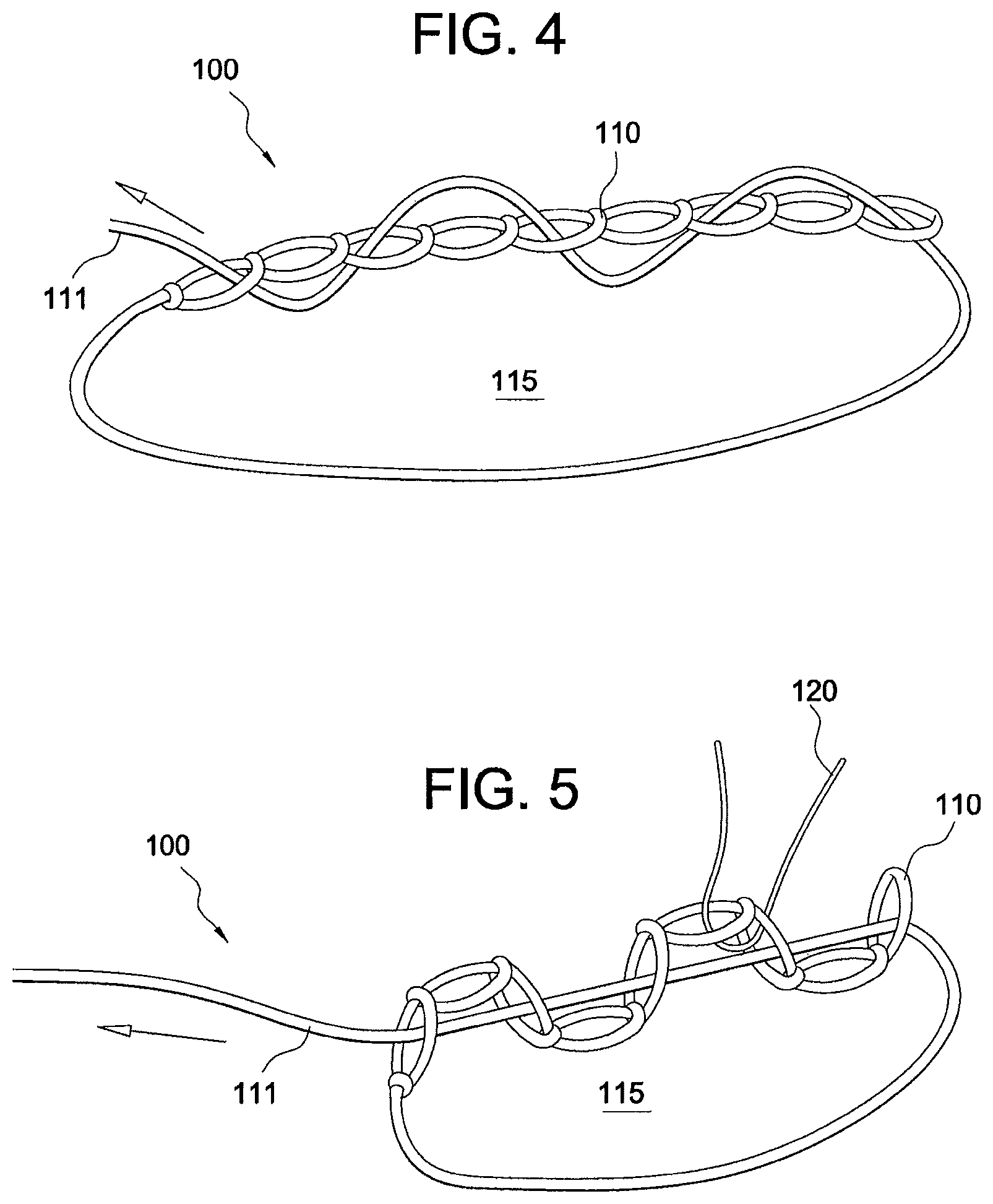 Patent US12324573 Figure 2 – Soft suture-based anchors