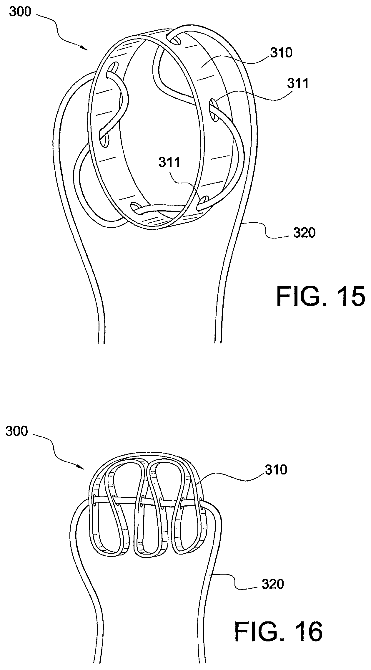 Patent US12324573 Figure 8 – Soft suture-based anchors