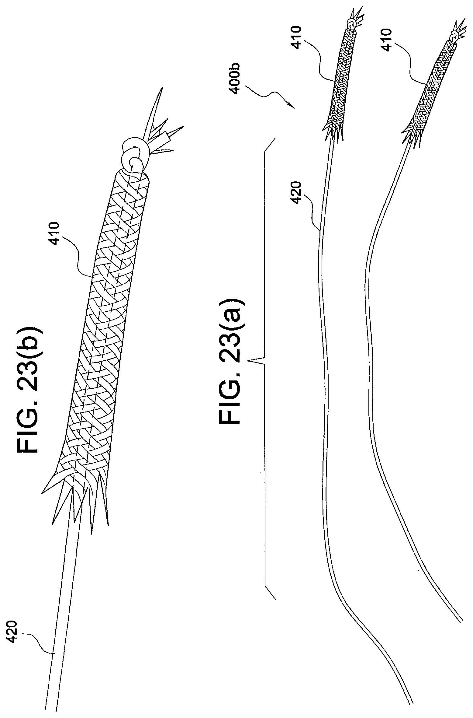 Patent US12324573 Figure 12 – Soft suture-based anchors