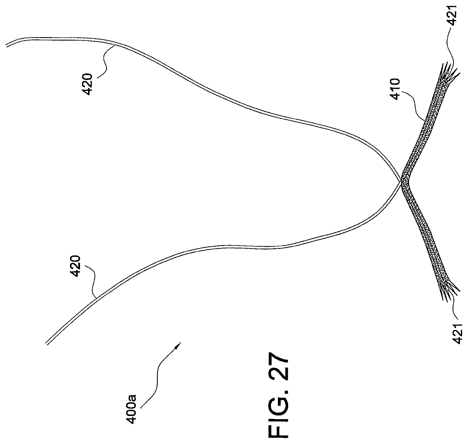 Patent US12324573 Figure 16 – Soft suture-based anchors