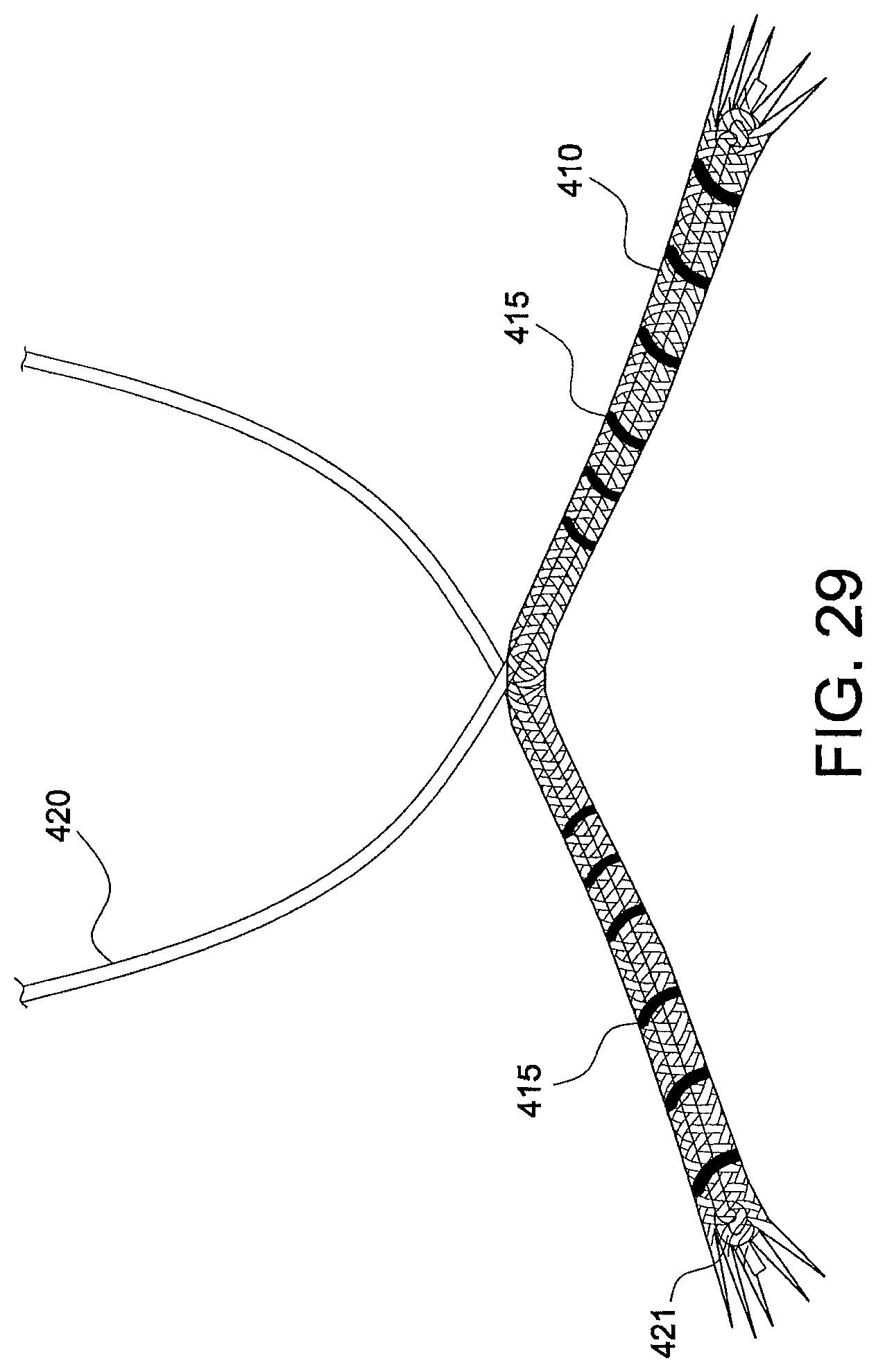 Patent US12324573 Figure 18 – Soft suture-based anchors