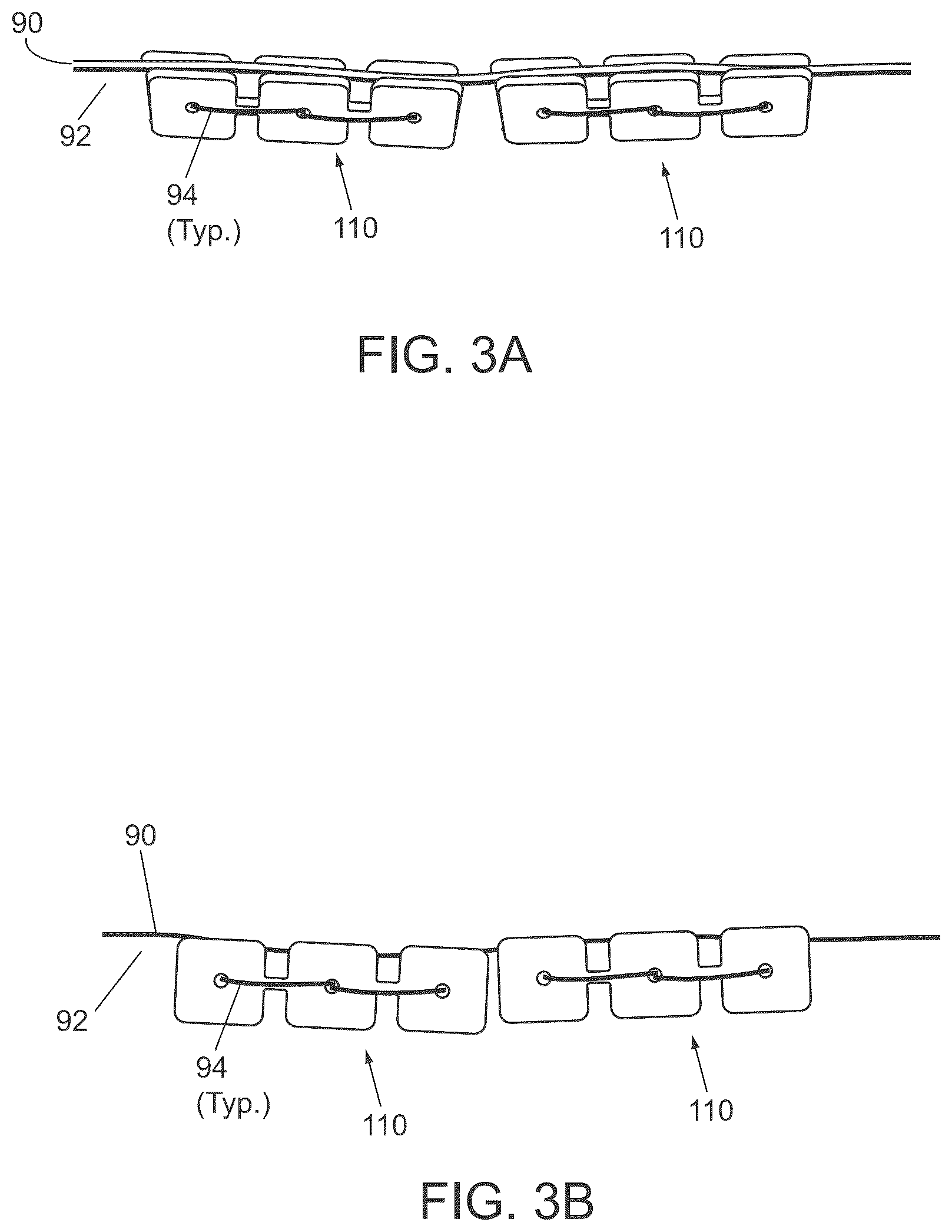 Patent US12324575 Figure 2 – Devices and methods for closing abdominal fascia and other incisions