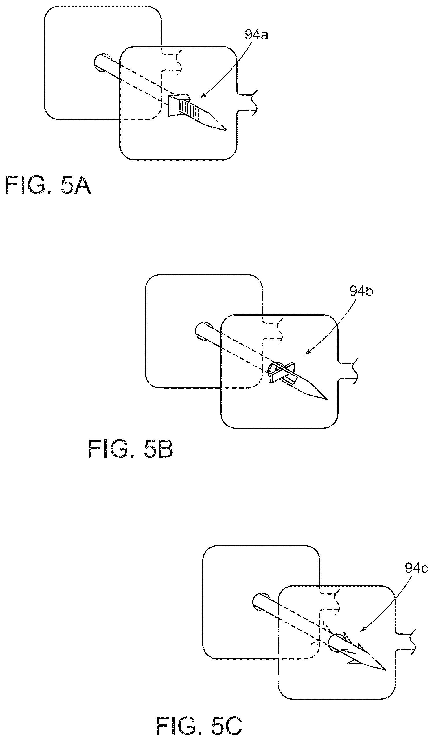 Patent US12324575 Figure 5 – Devices and methods for closing abdominal fascia and other incisions