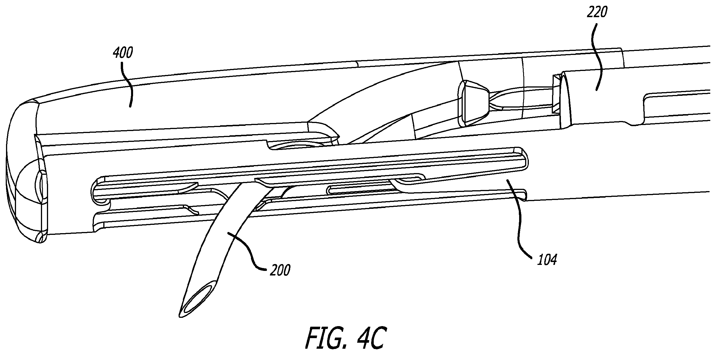 Patent US12324576 Figure 5 – Flexible system for delivering an anchor