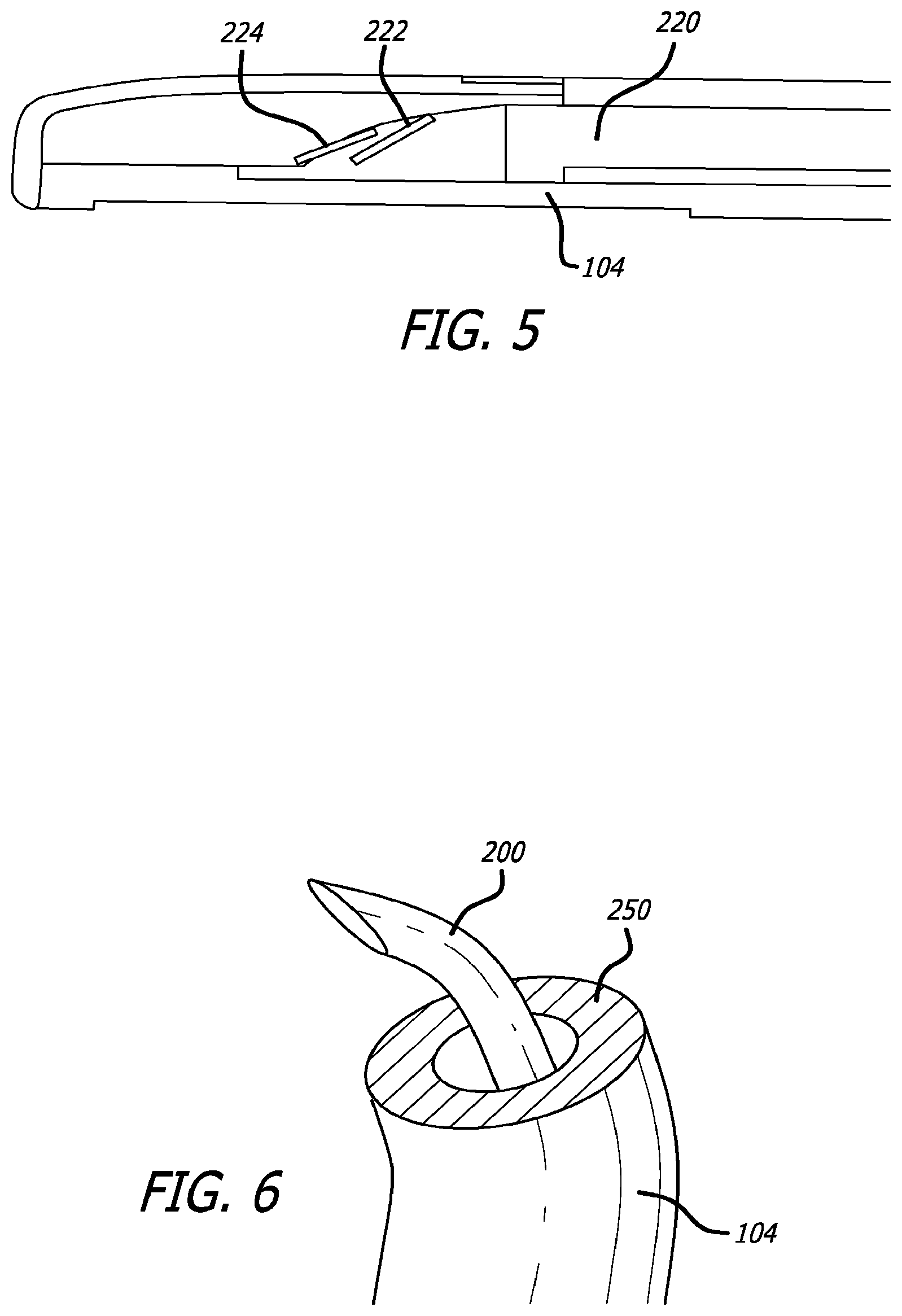 Patent US12324576 Figure 6 – Flexible system for delivering an anchor
