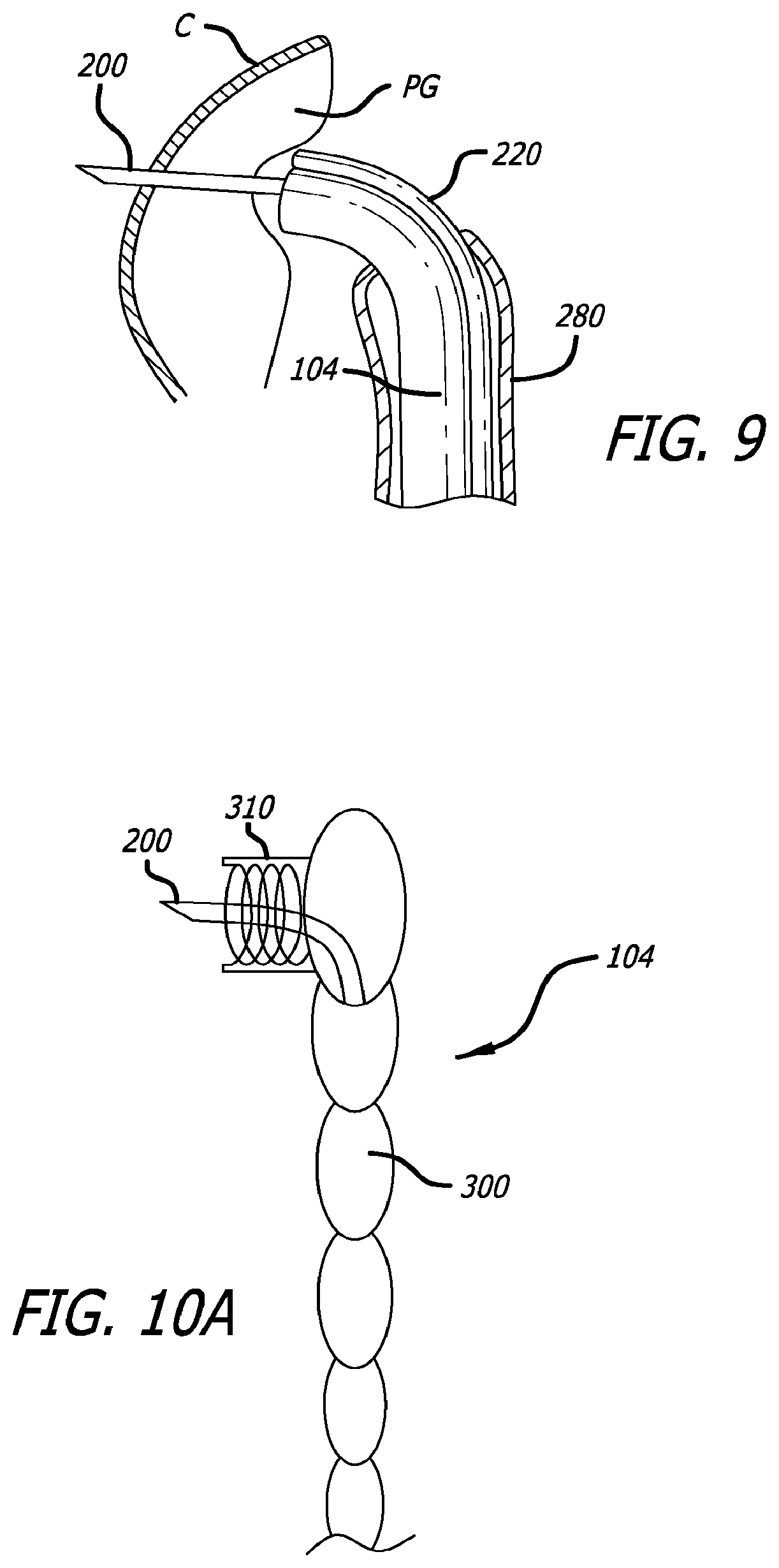 Patent US12324576 Figure 8 – Flexible system for delivering an anchor