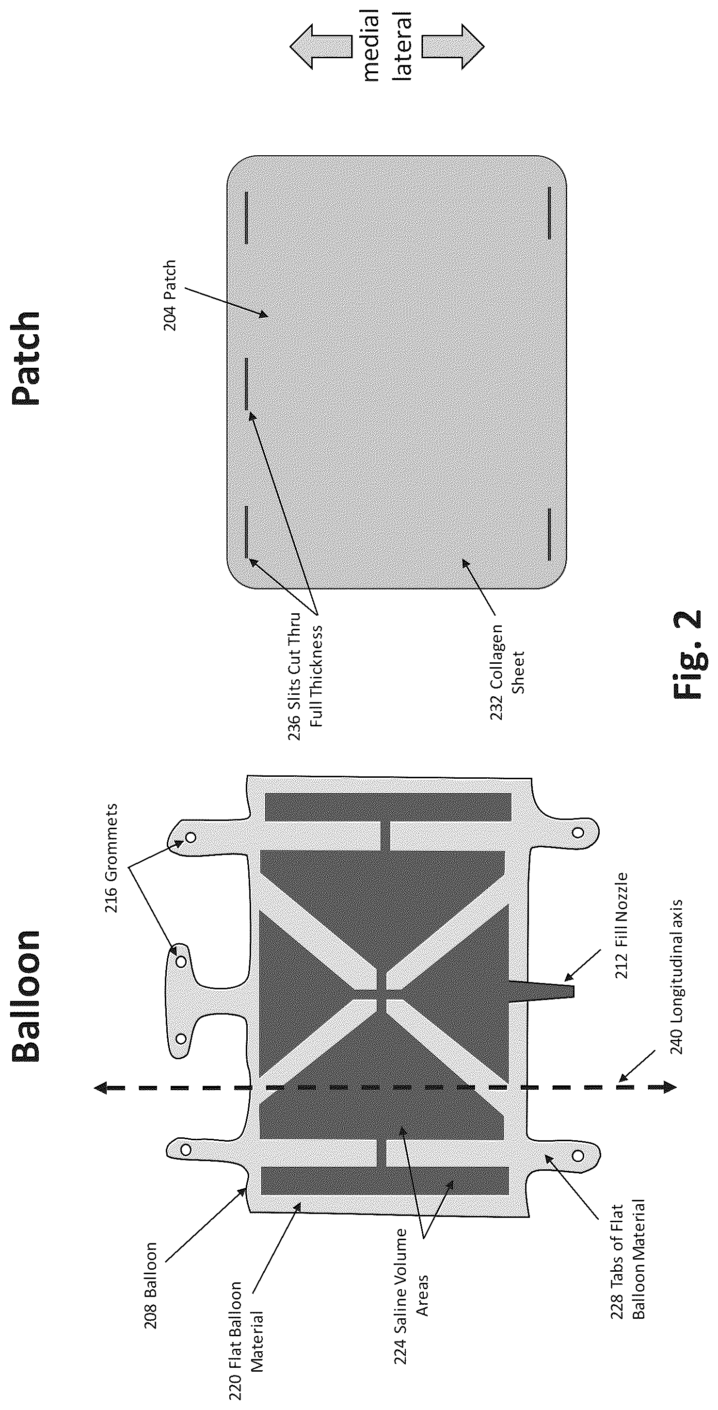 Patent US12324577 Figure 2 – Method of augmenting tissue