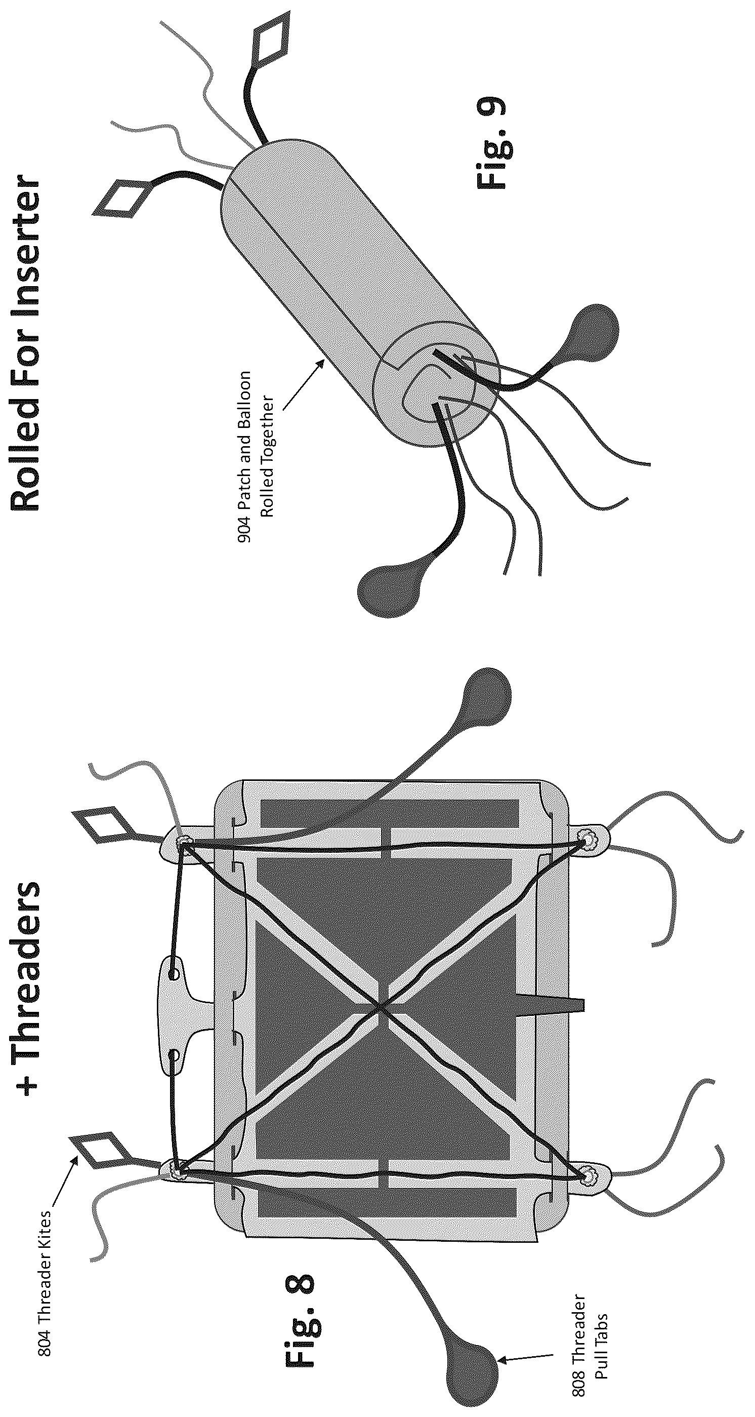 Patent US12324577 Figure 6 – Method of augmenting tissue