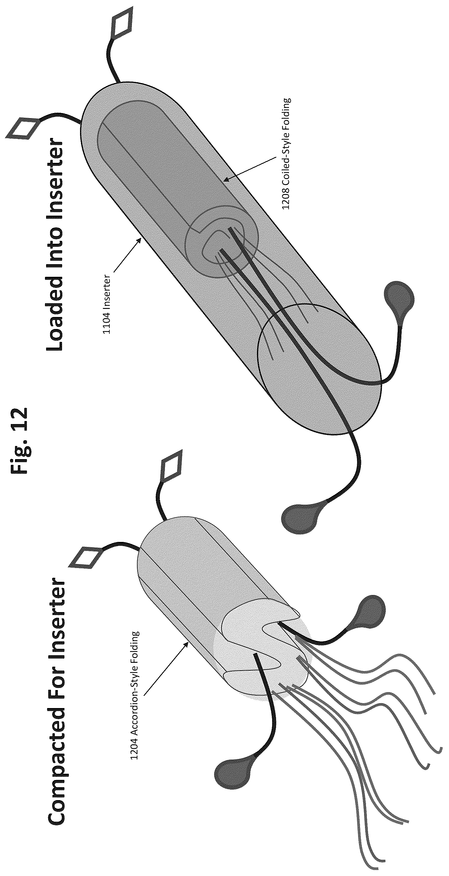Patent US12324577 Figure 9 – Method of augmenting tissue