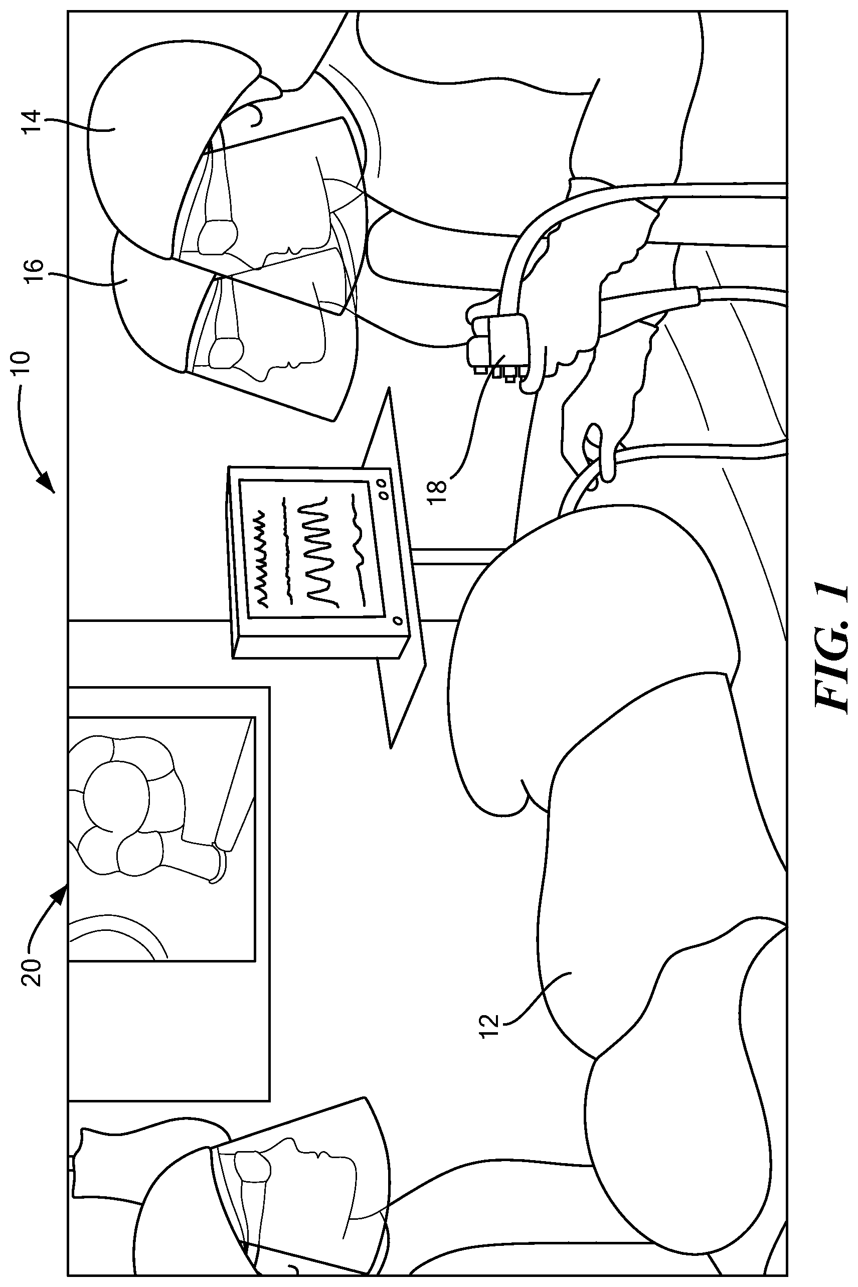 Patent US12324578 Figure 1 – Endoscopic suture cinch