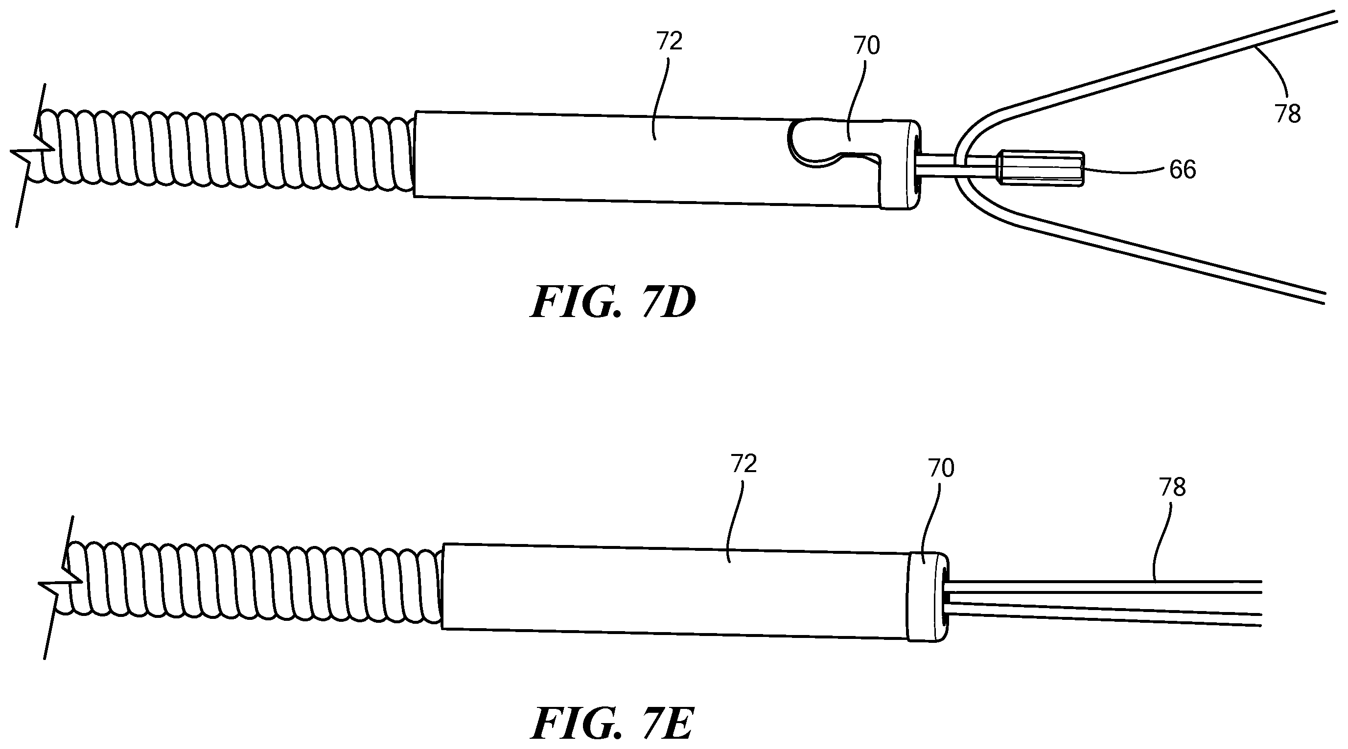 Patent US12324578 Figure 11 – Endoscopic suture cinch