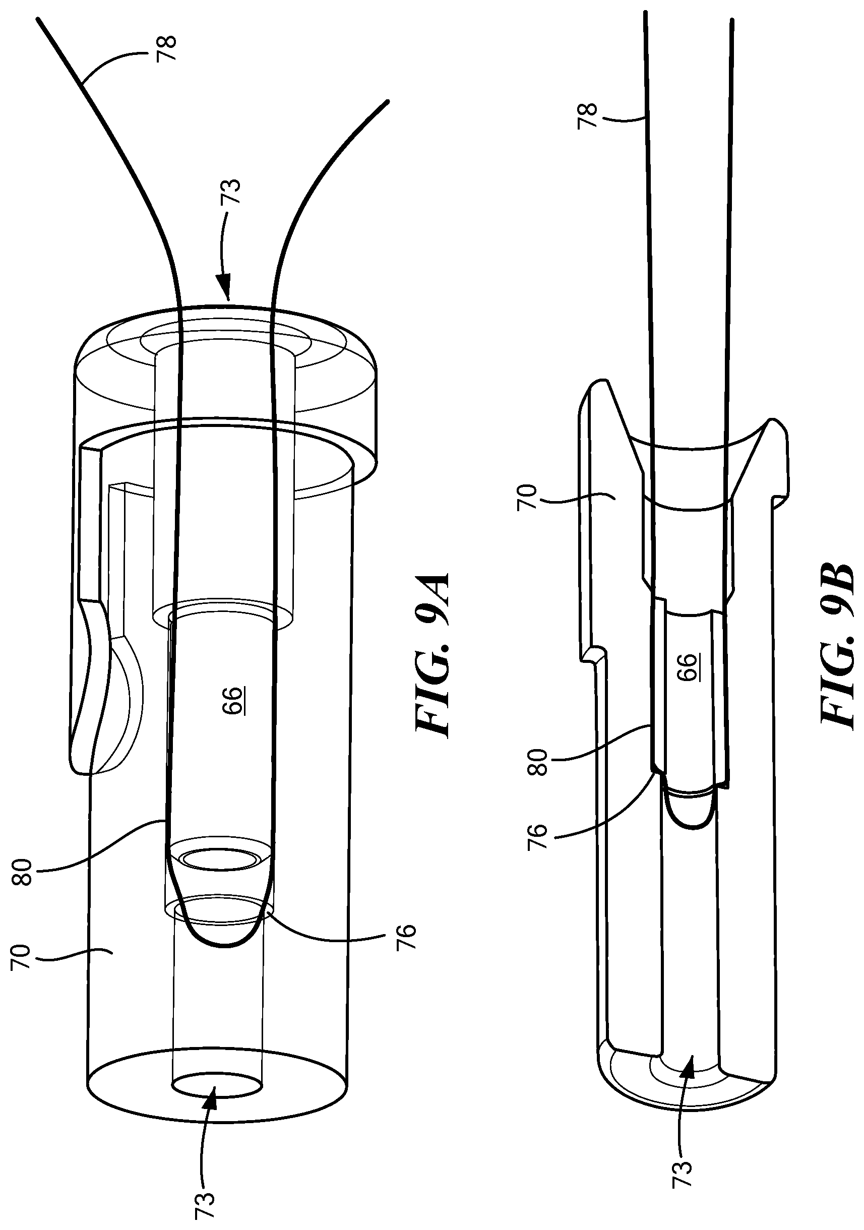 Patent US12324578 Figure 13 – Endoscopic suture cinch