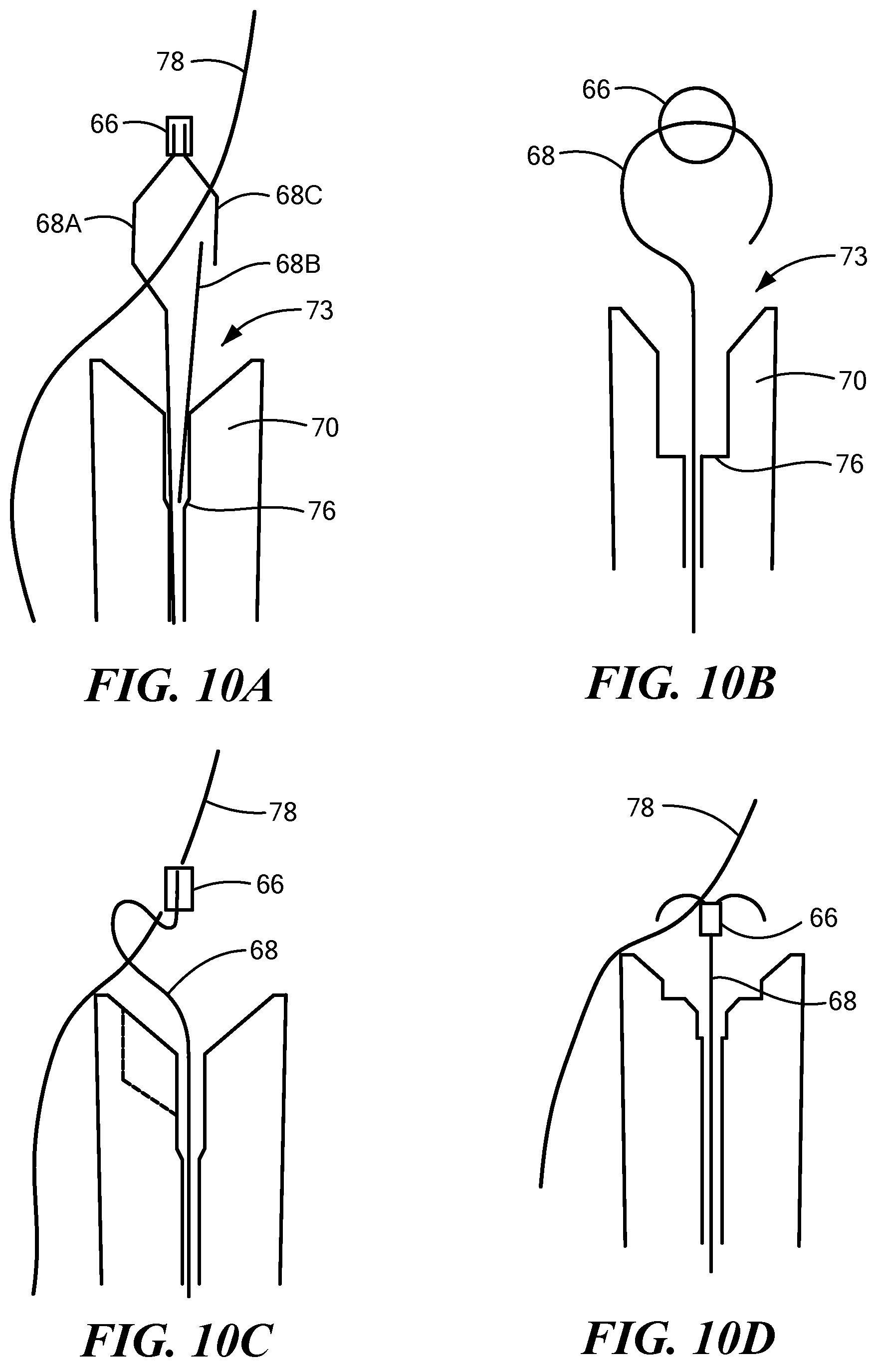 Patent US12324578 Figure 14 – Endoscopic suture cinch