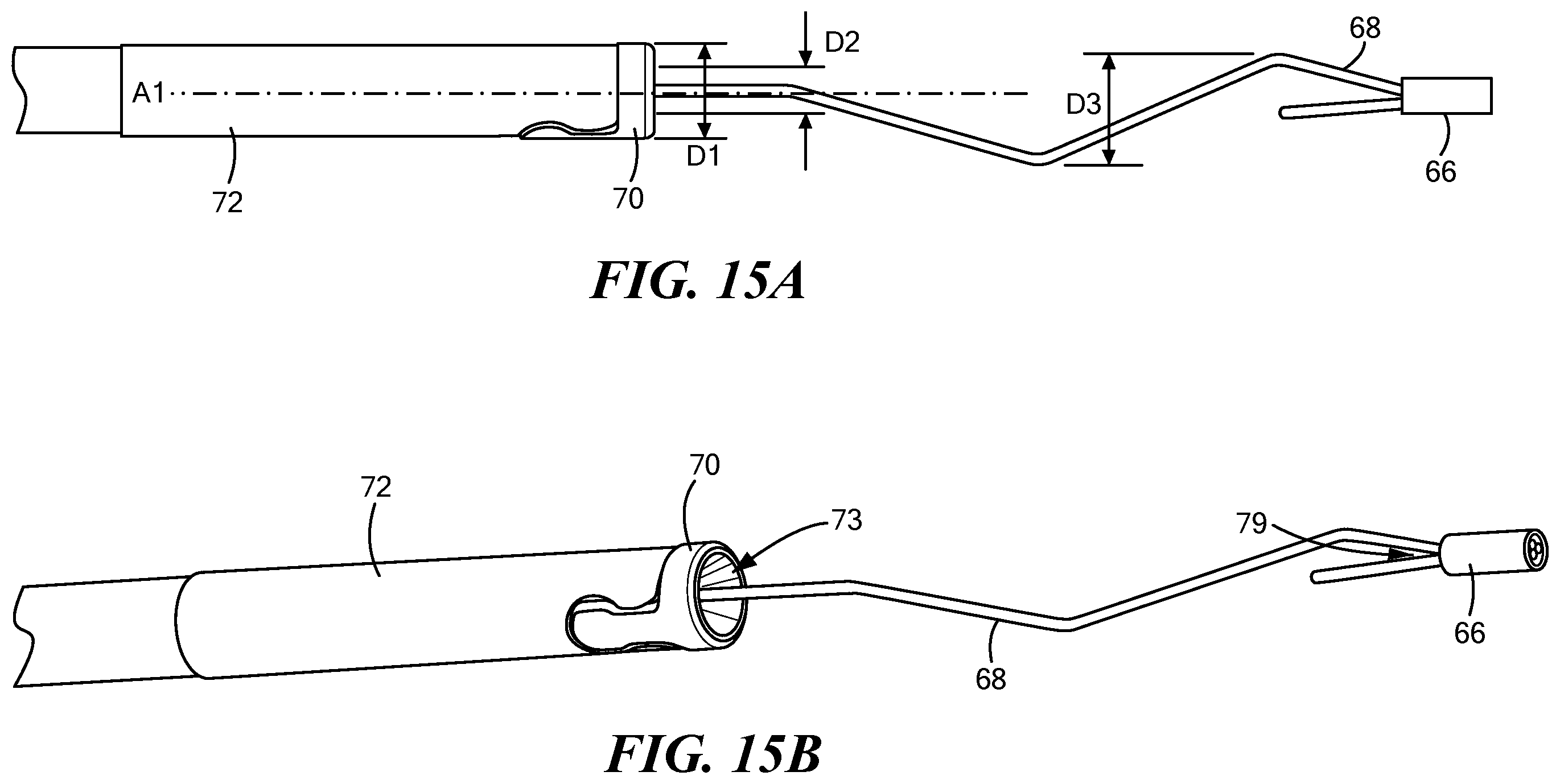 Patent US12324578 Figure 19 – Endoscopic suture cinch