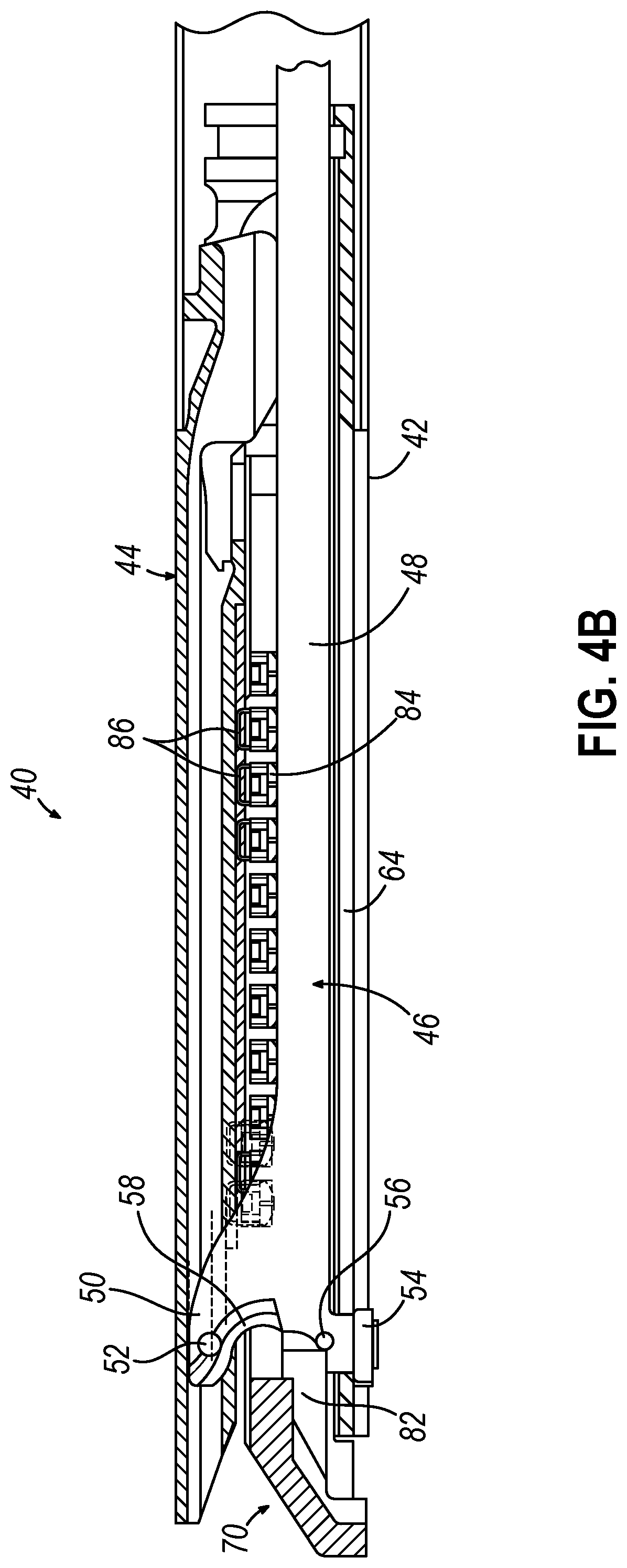 Patent US12324583 Figure 5 – Incompatible staple cartridge use prevention features for surgical stapler