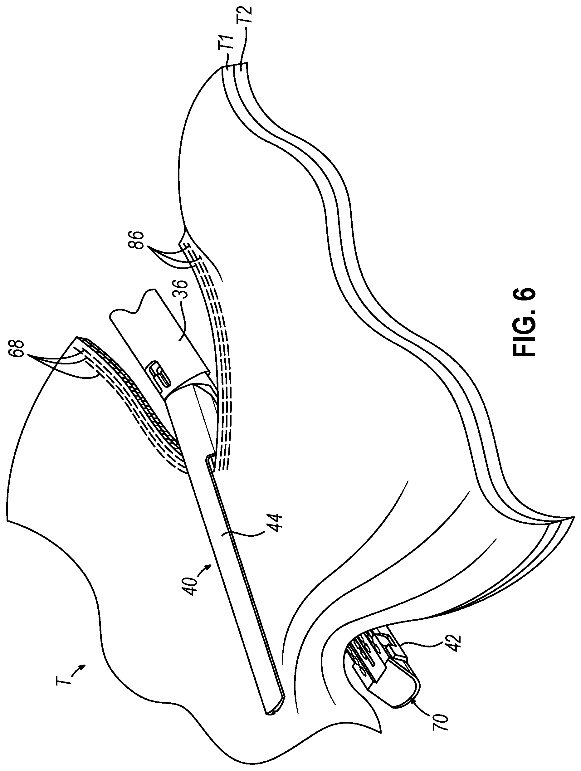 Patent US12324583 Figure 7 – Incompatible staple cartridge use prevention features for surgical stapler