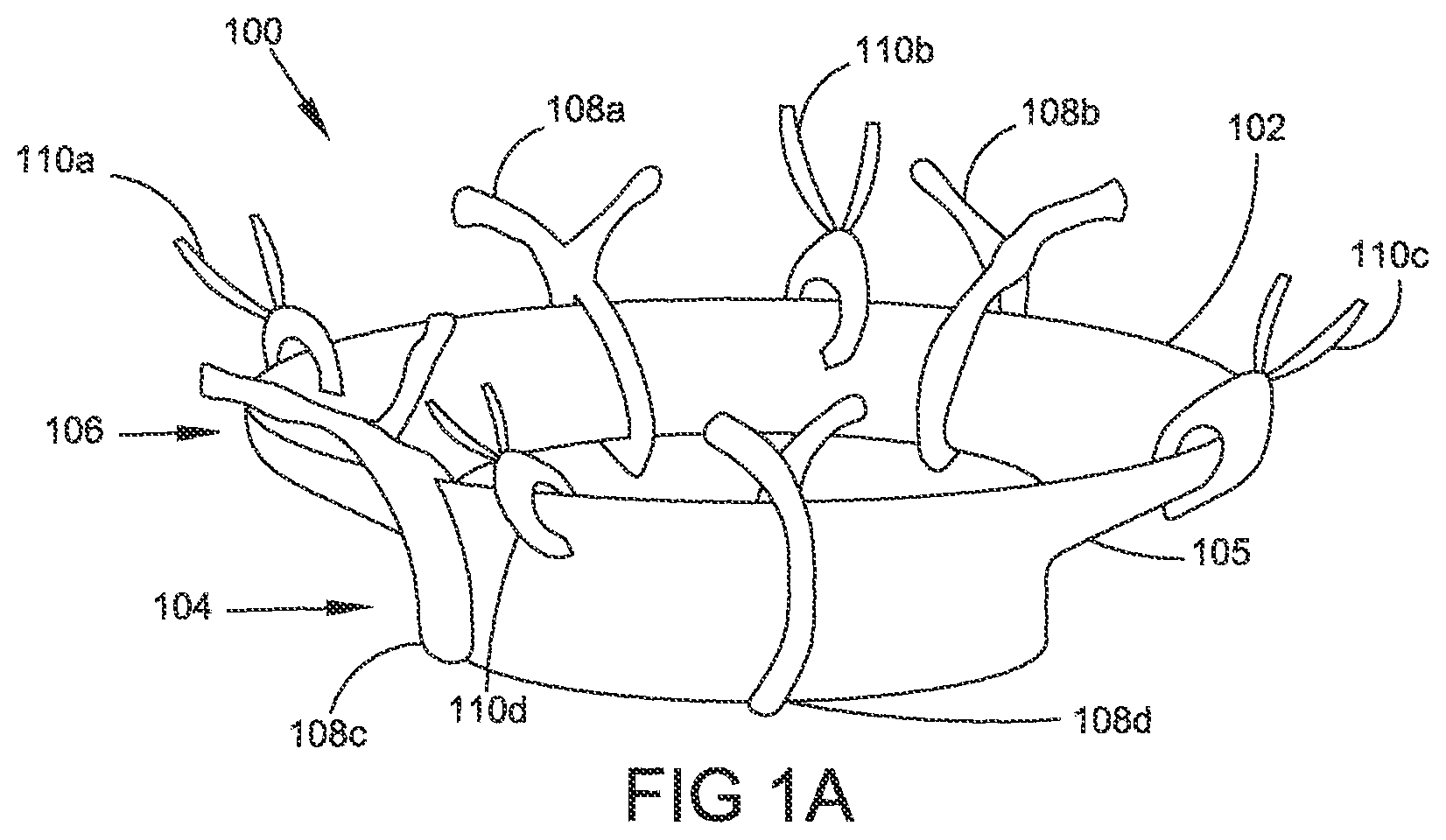 Patent US12324586 Figure 1 – Apparatus and methods for managing a shape of a junction between a bladder and urethra
