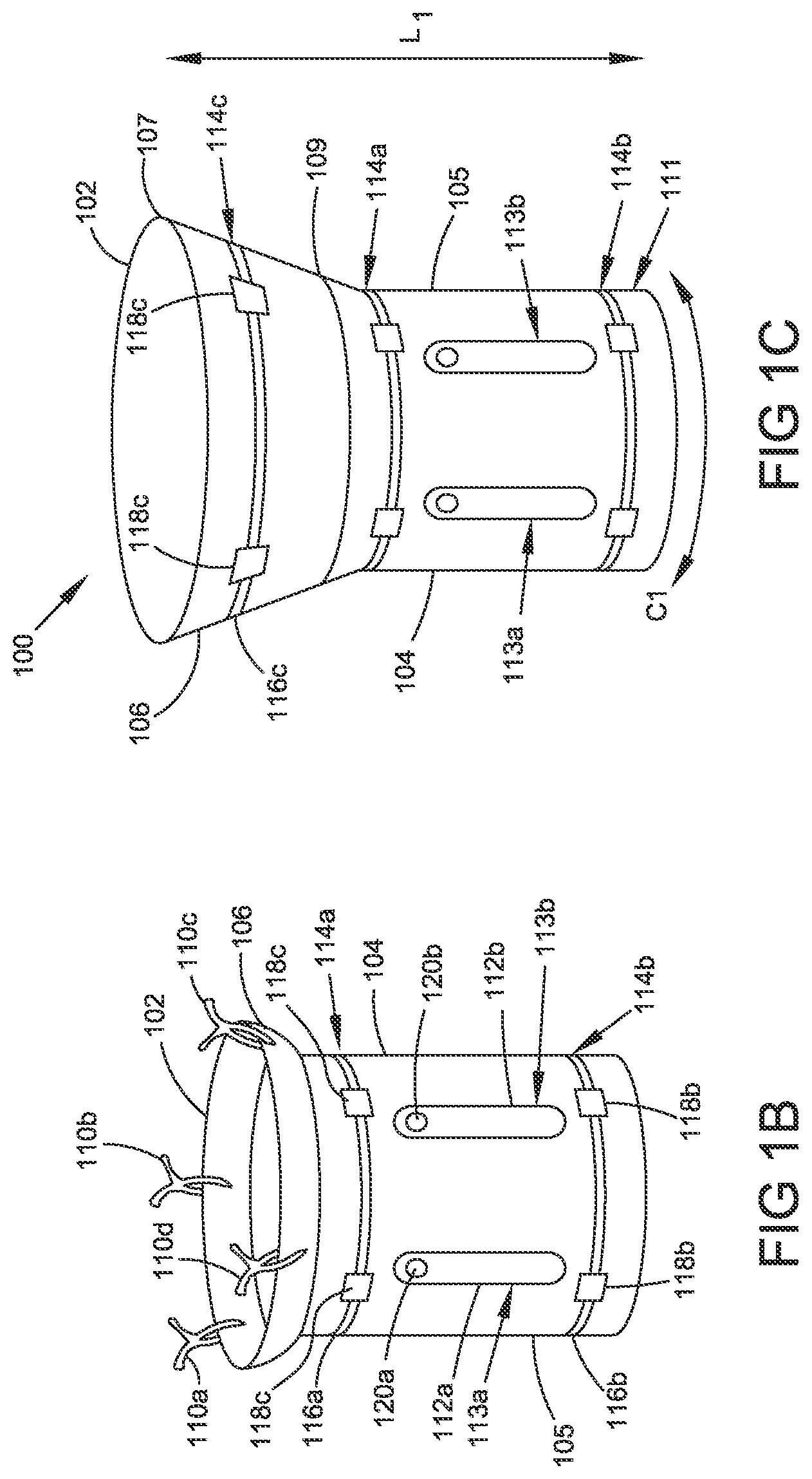 Patent US12324586 Figure 2 – Apparatus and methods for managing a shape of a junction between a bladder and urethra